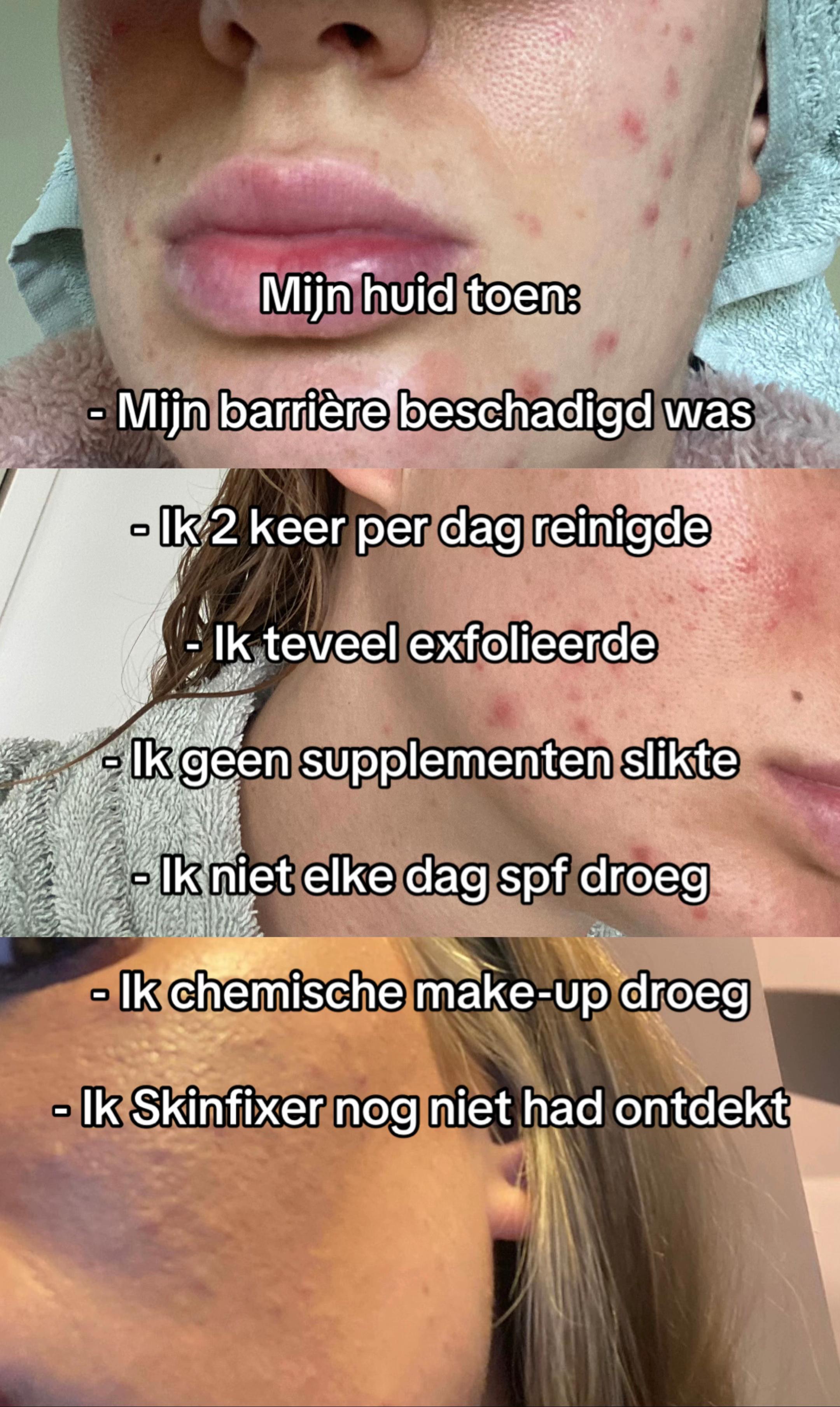 @Rebecca | Huidtherapeut✨