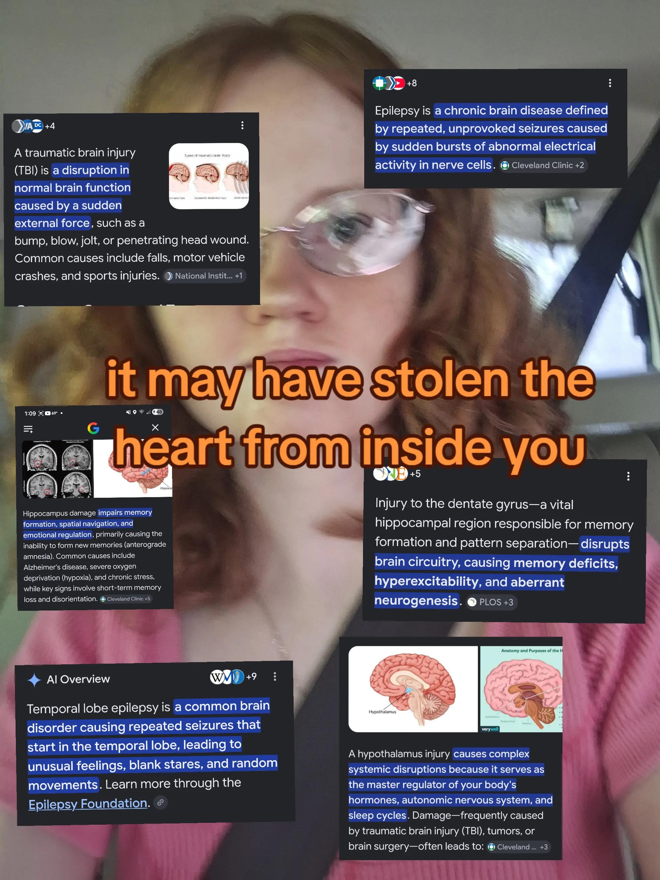 @Michaellaspam