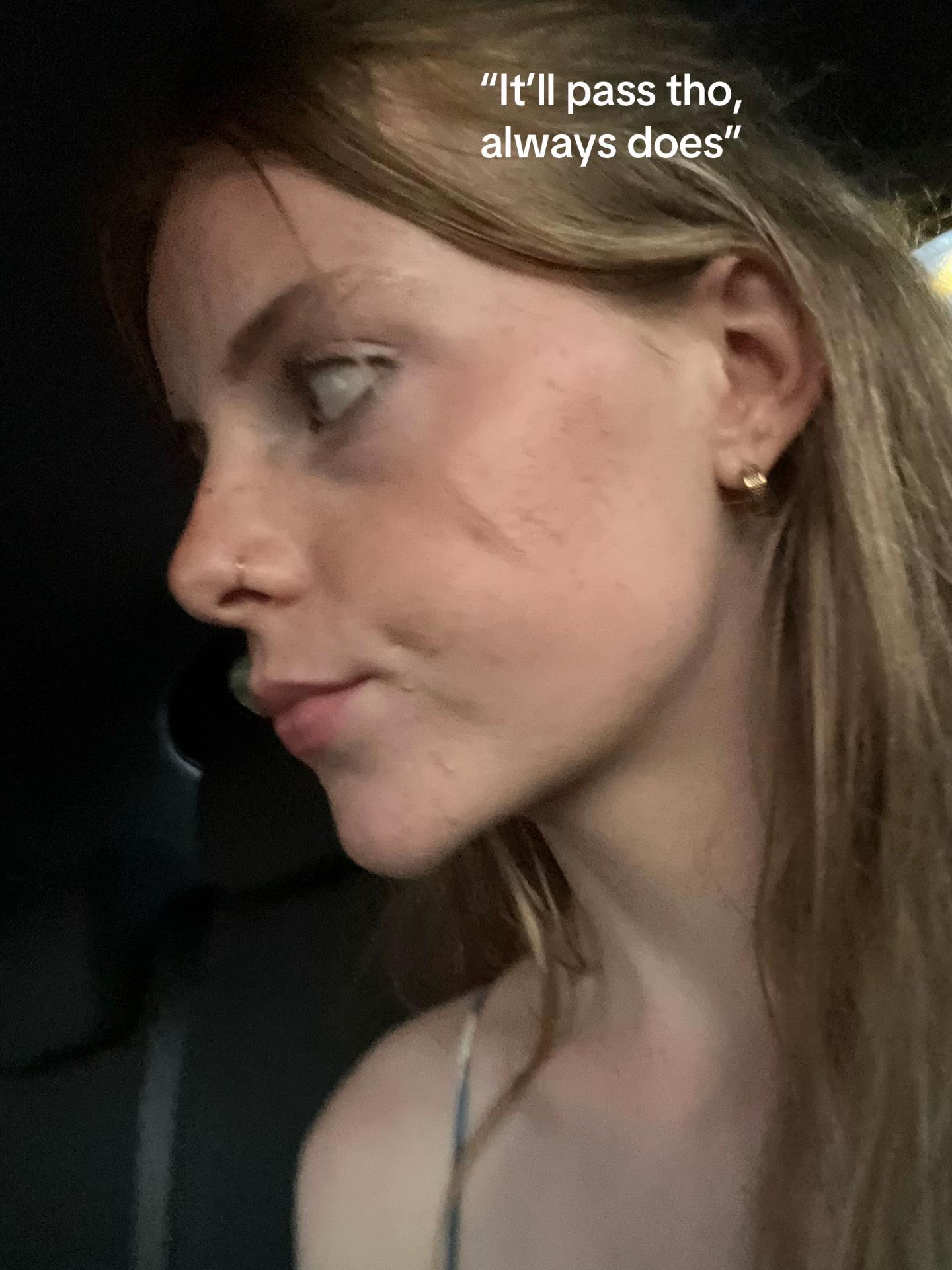 @lyss