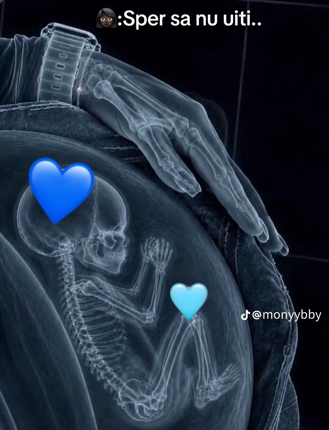 @♡︎☠︎︎𝔸𝕃𝔼𝕏𝔸__Marius❤️👶🏻