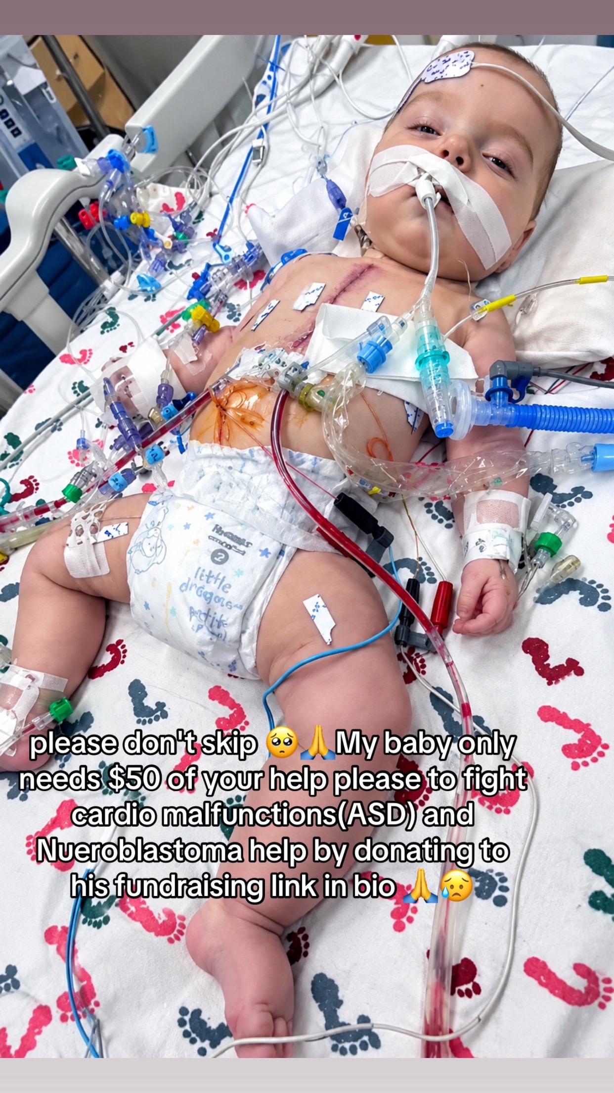 @SAVE ISAAC JAX๐๐