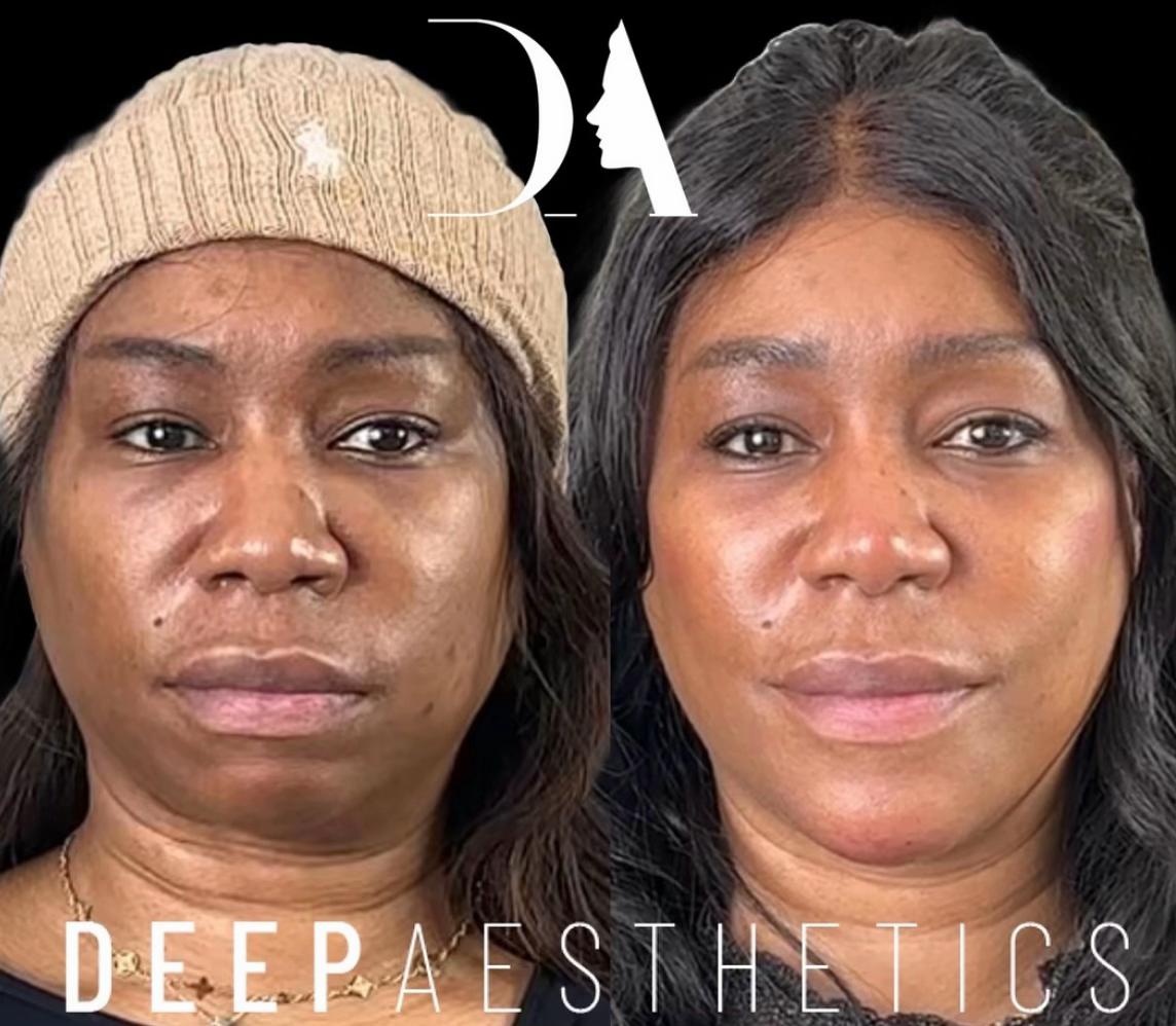 @deepaesthetics_official