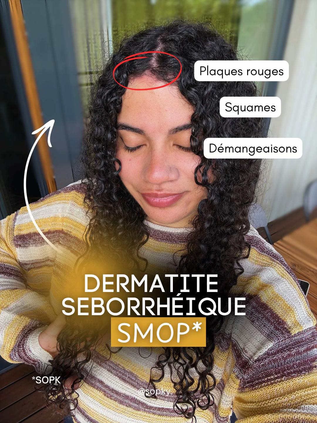 @Ascher | SMOP Girl