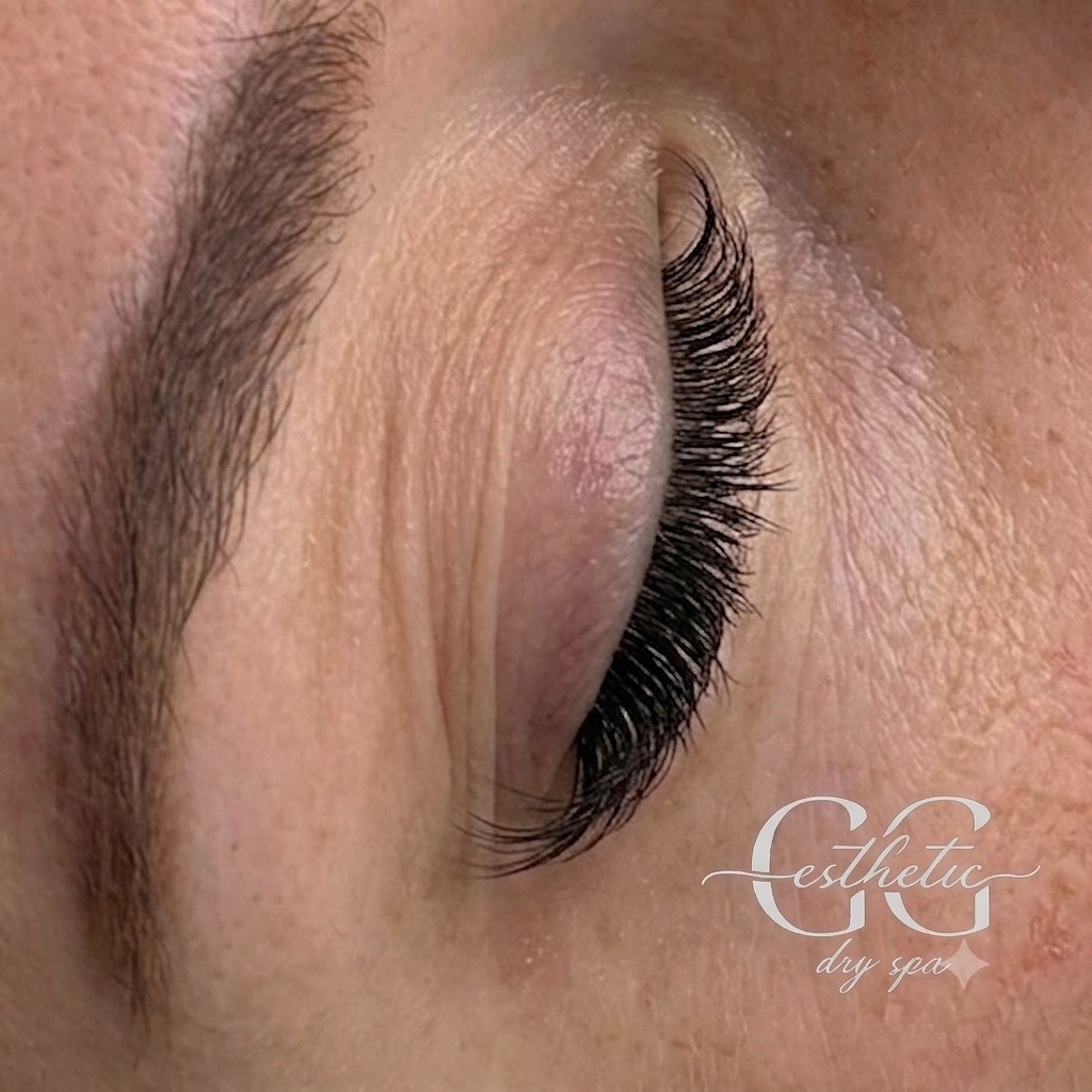 @♡ GG ESTHETICS ♡