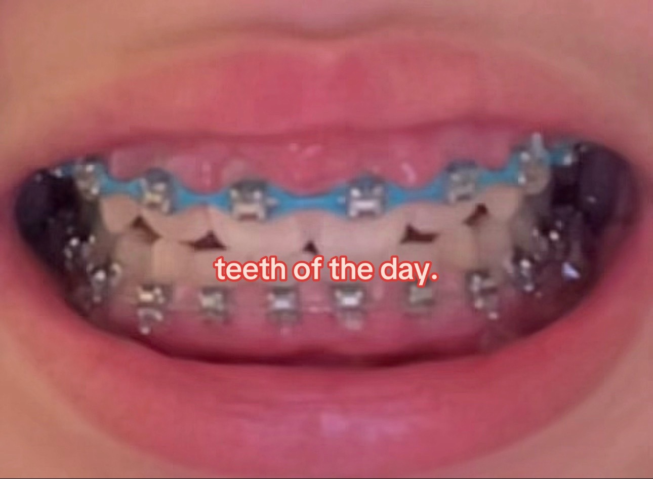 @I leik teeth moer thna mysefl.