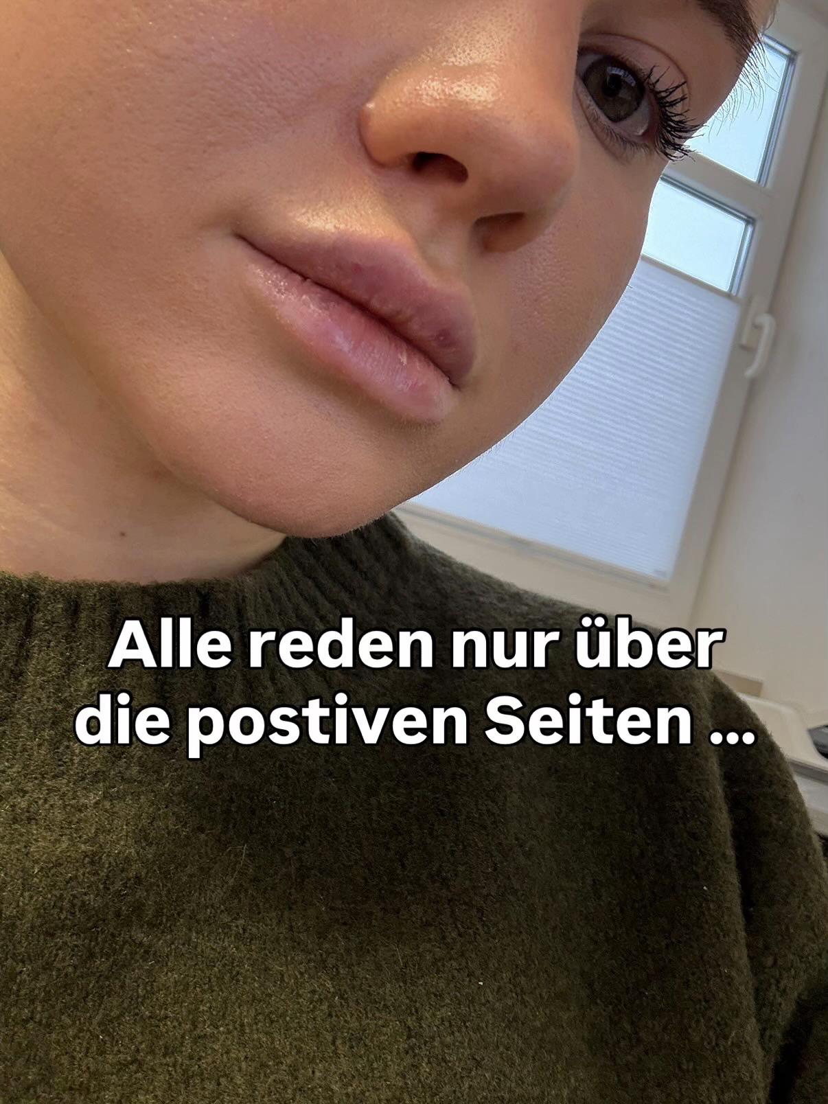 @jonas__vitalis