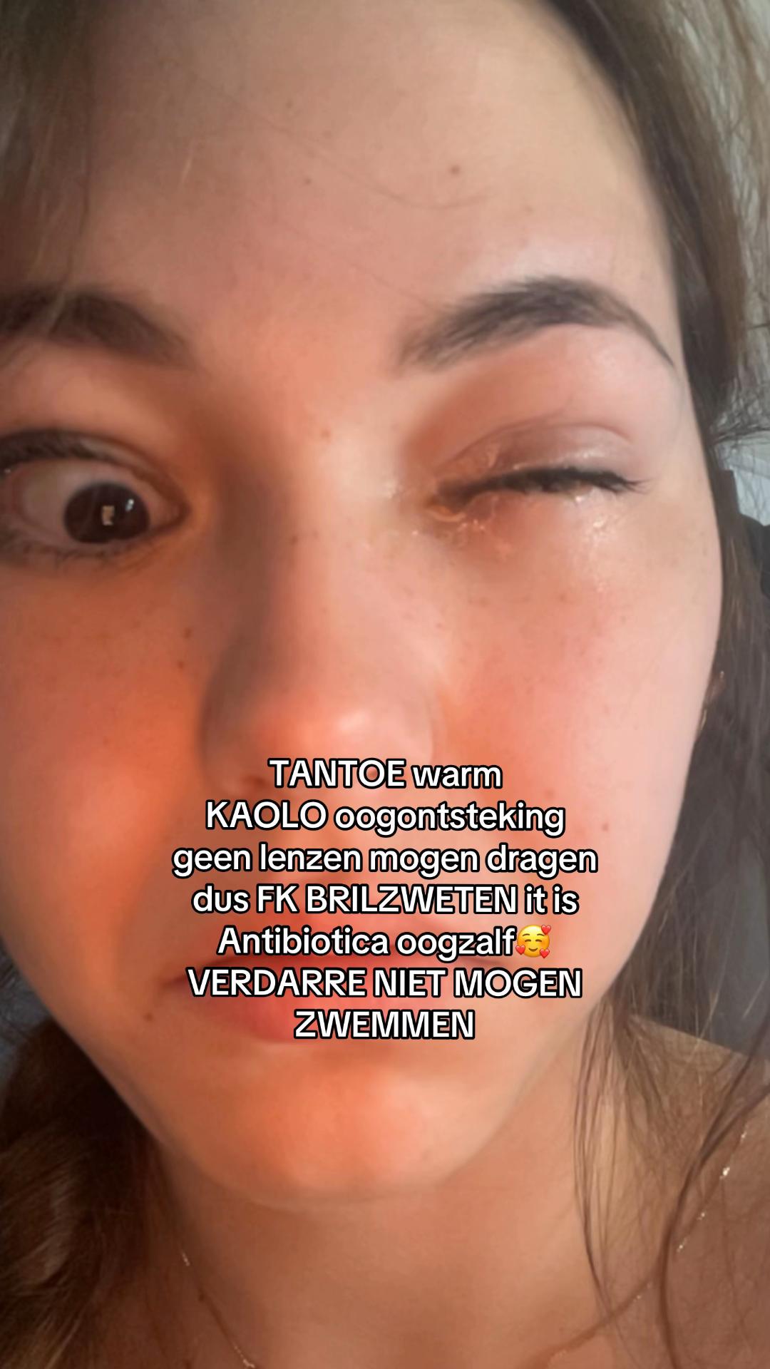 @Tesss