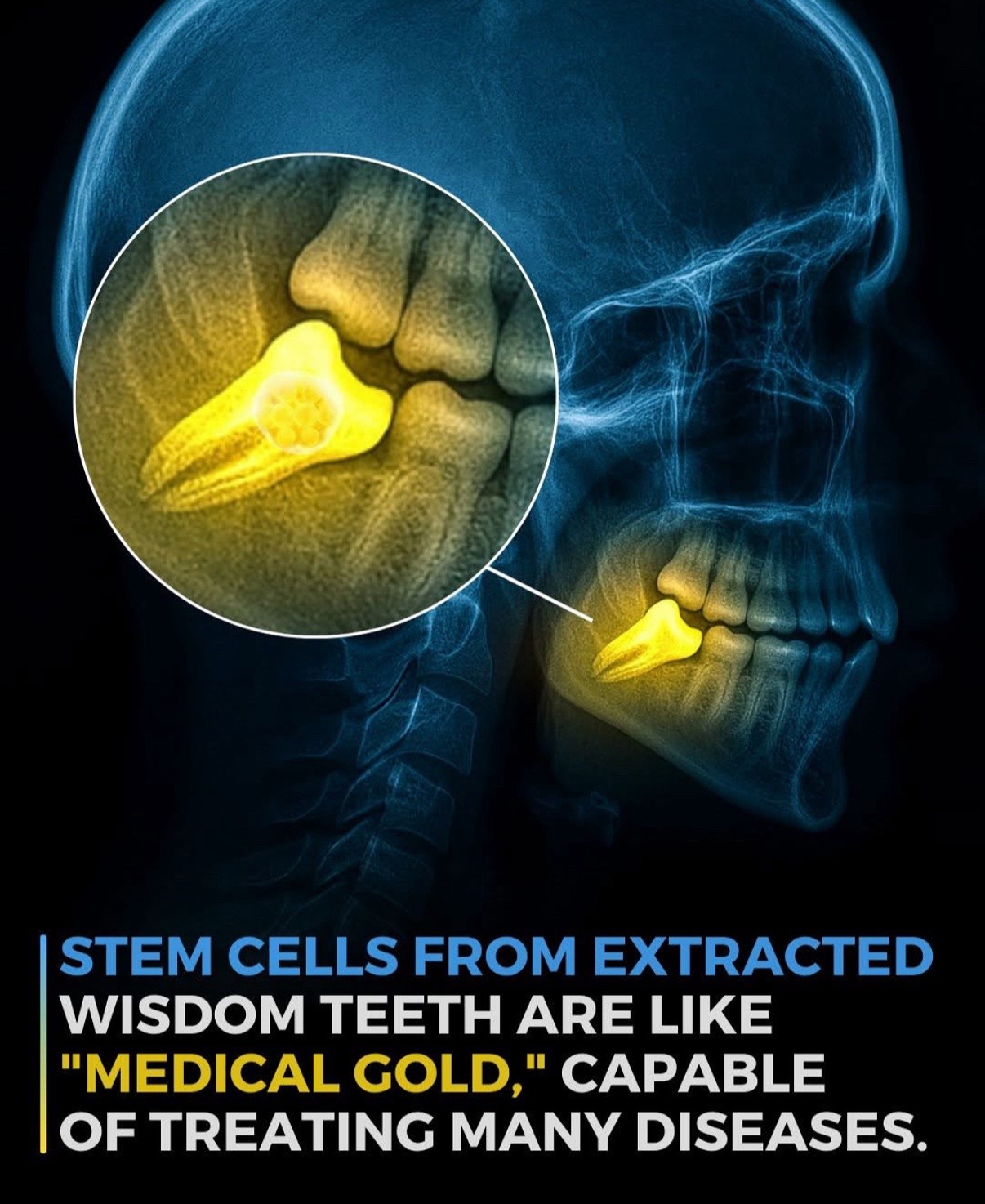 @Dentite
