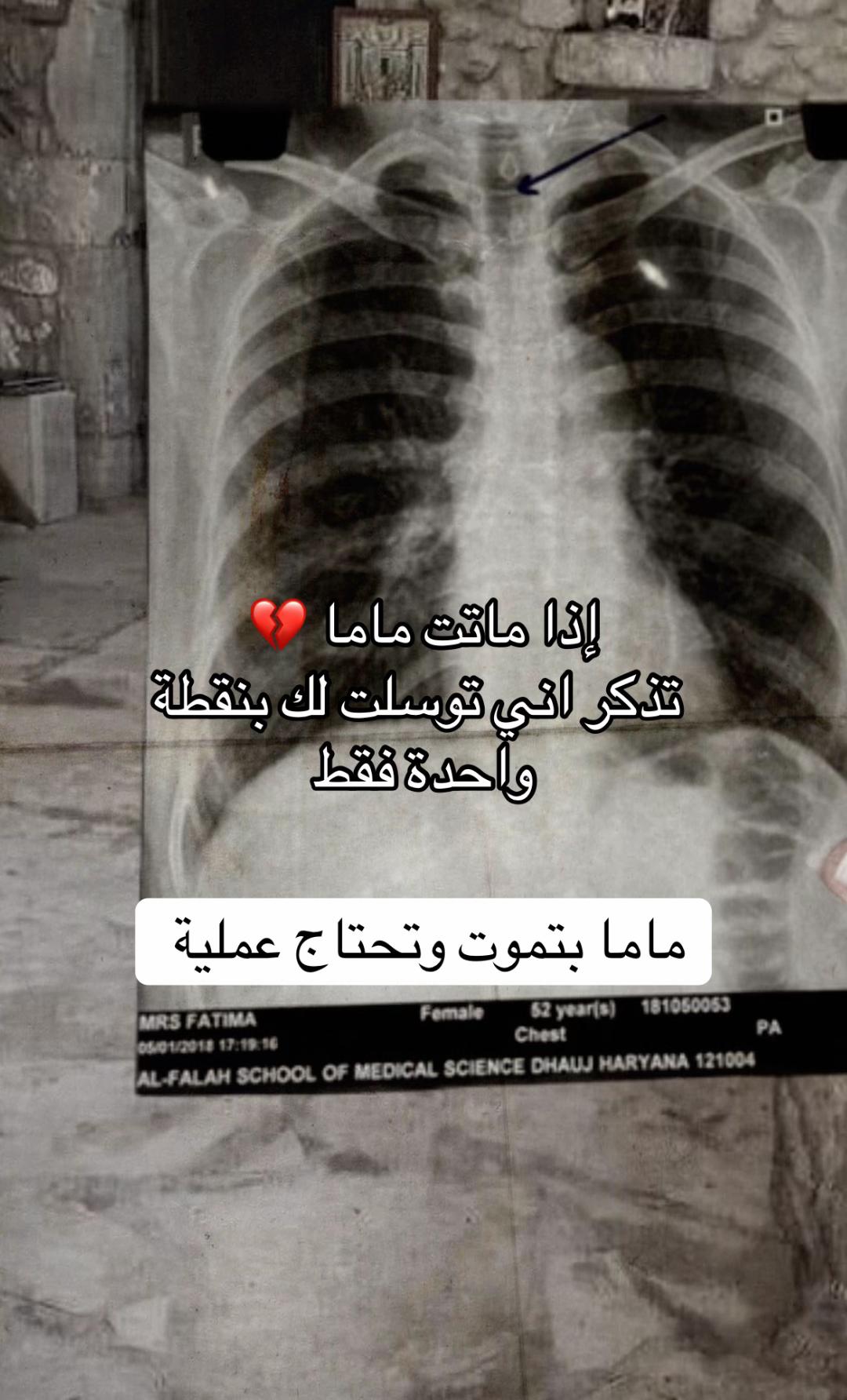 @MALAK