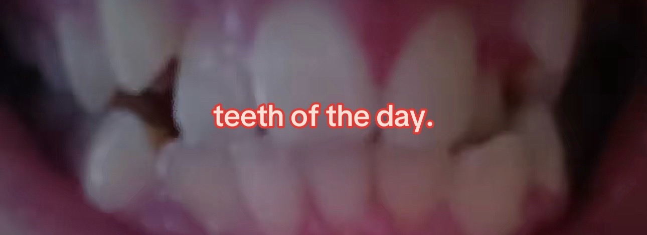 @I leik teeth moer thna mysefl.
