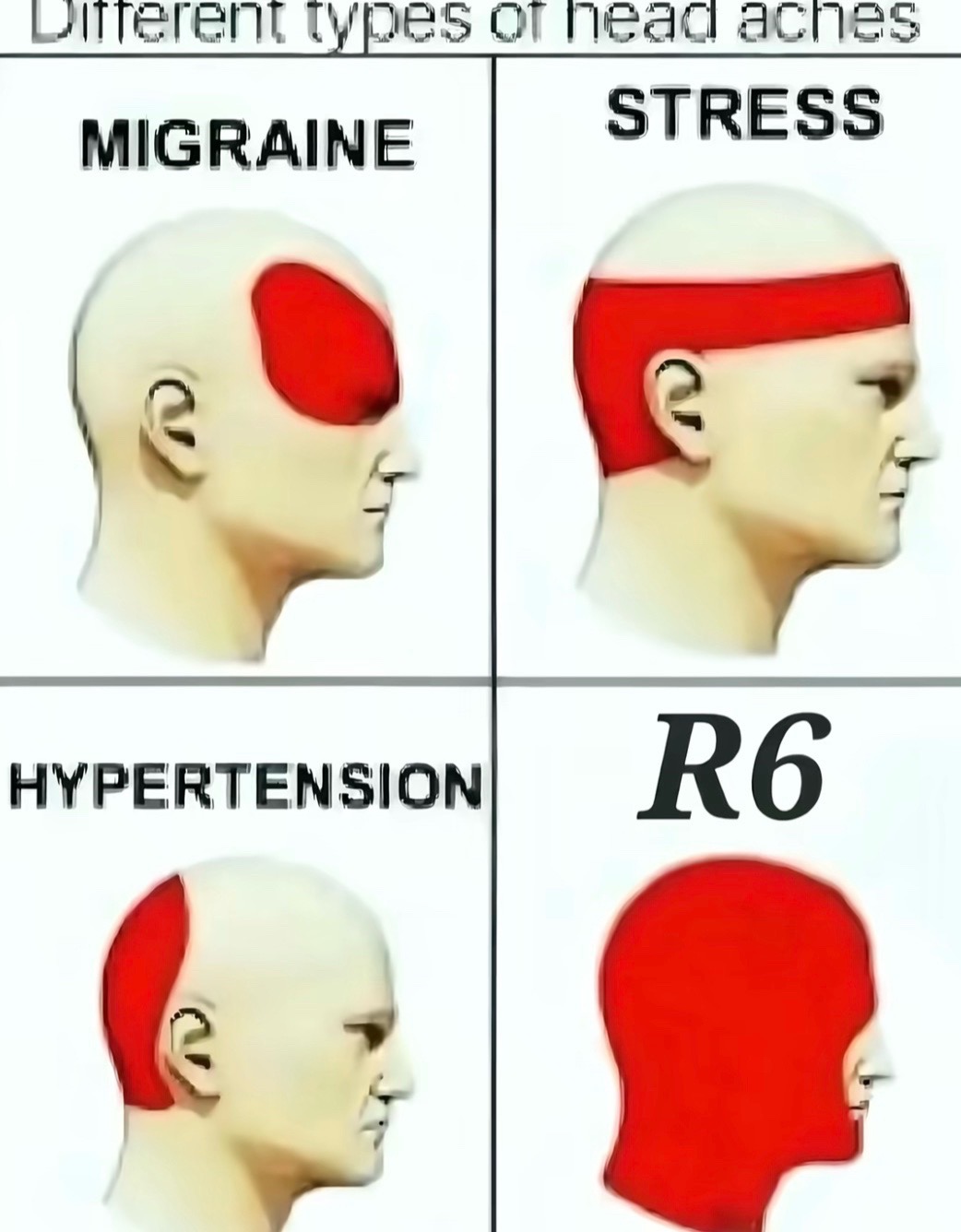 @R6King