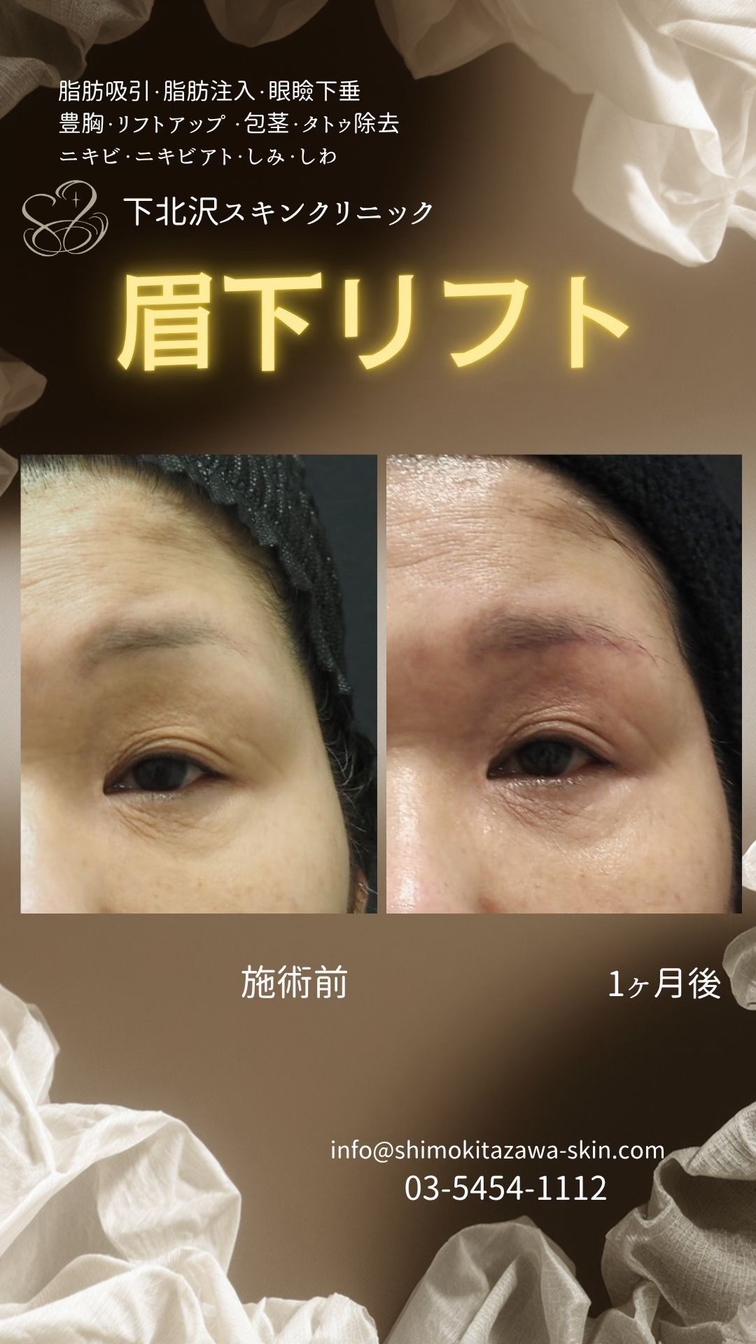 @下北沢スキンクリニック院長・こころの美容外科医・保坂宗孝