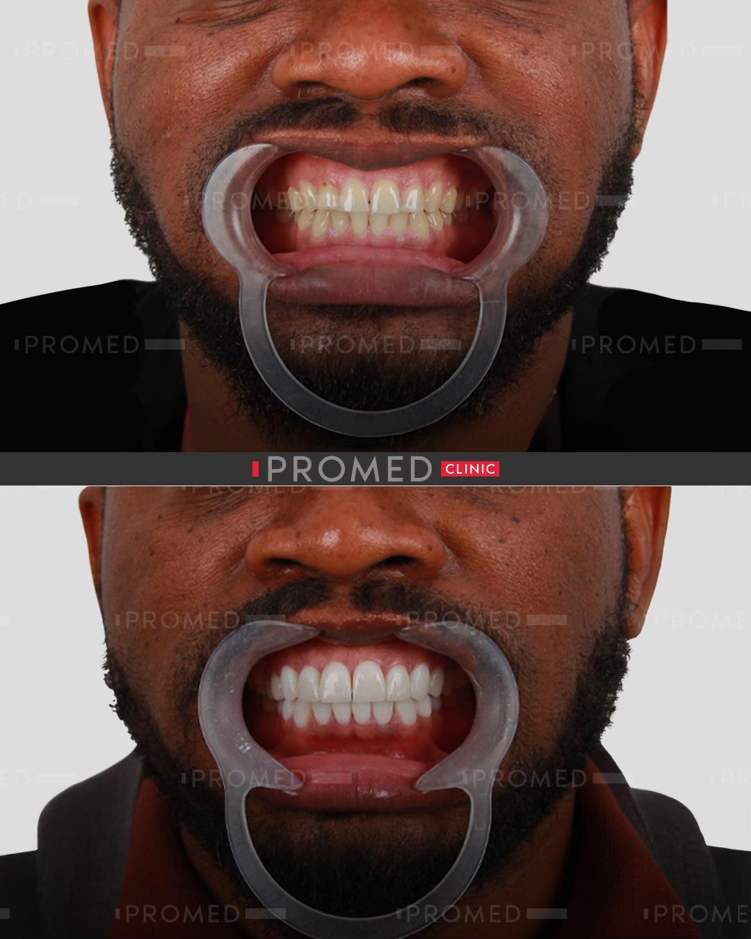 @promeddentalclinic