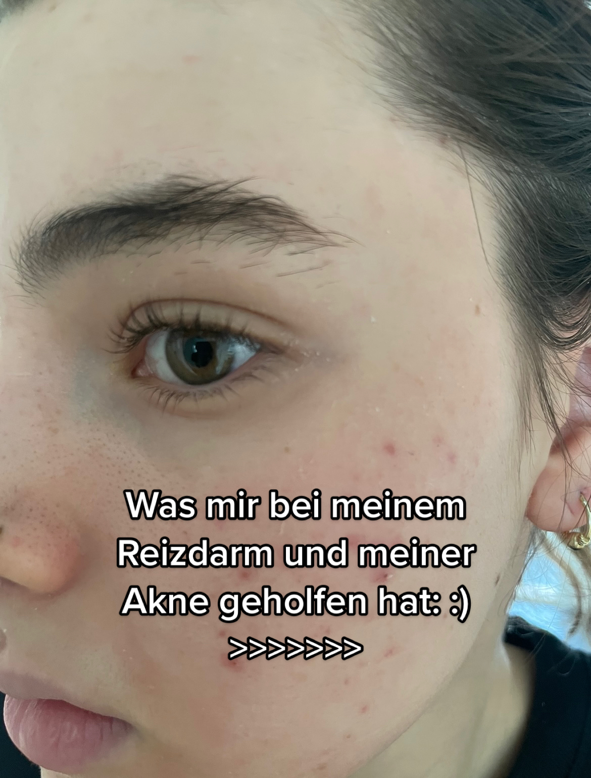 @Anna-Maria <3