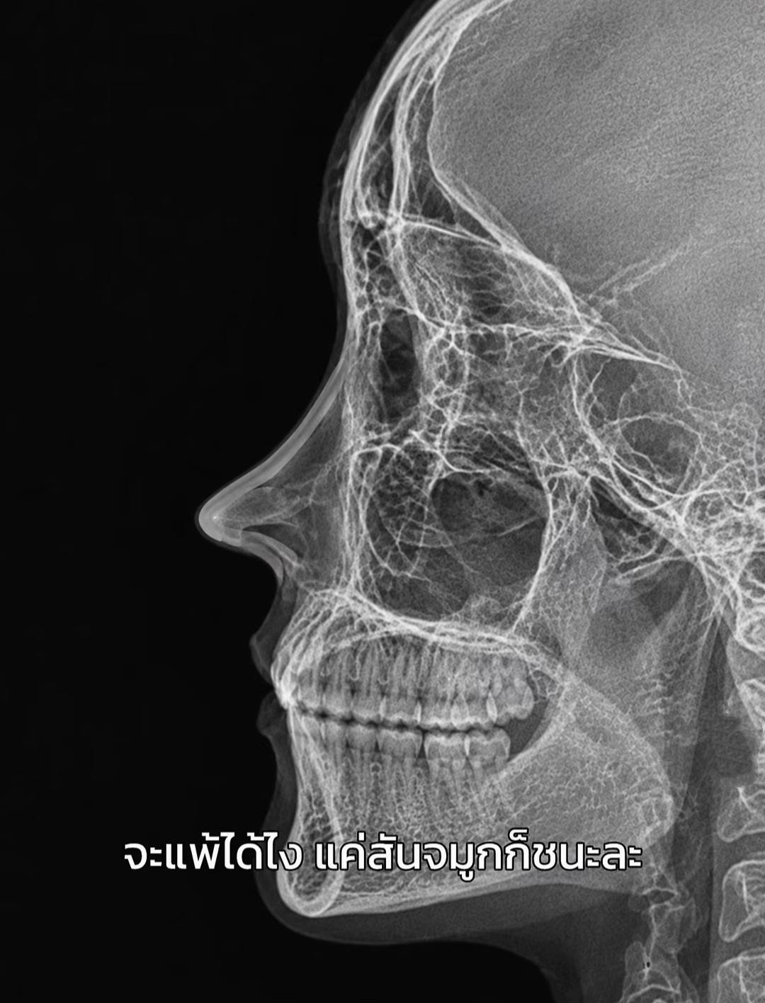 @กิ๊กสุจิตตา