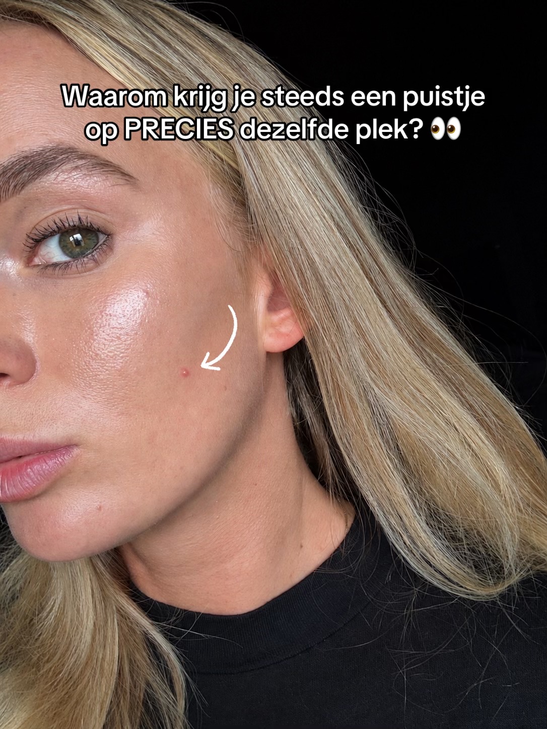 @Skinfixer