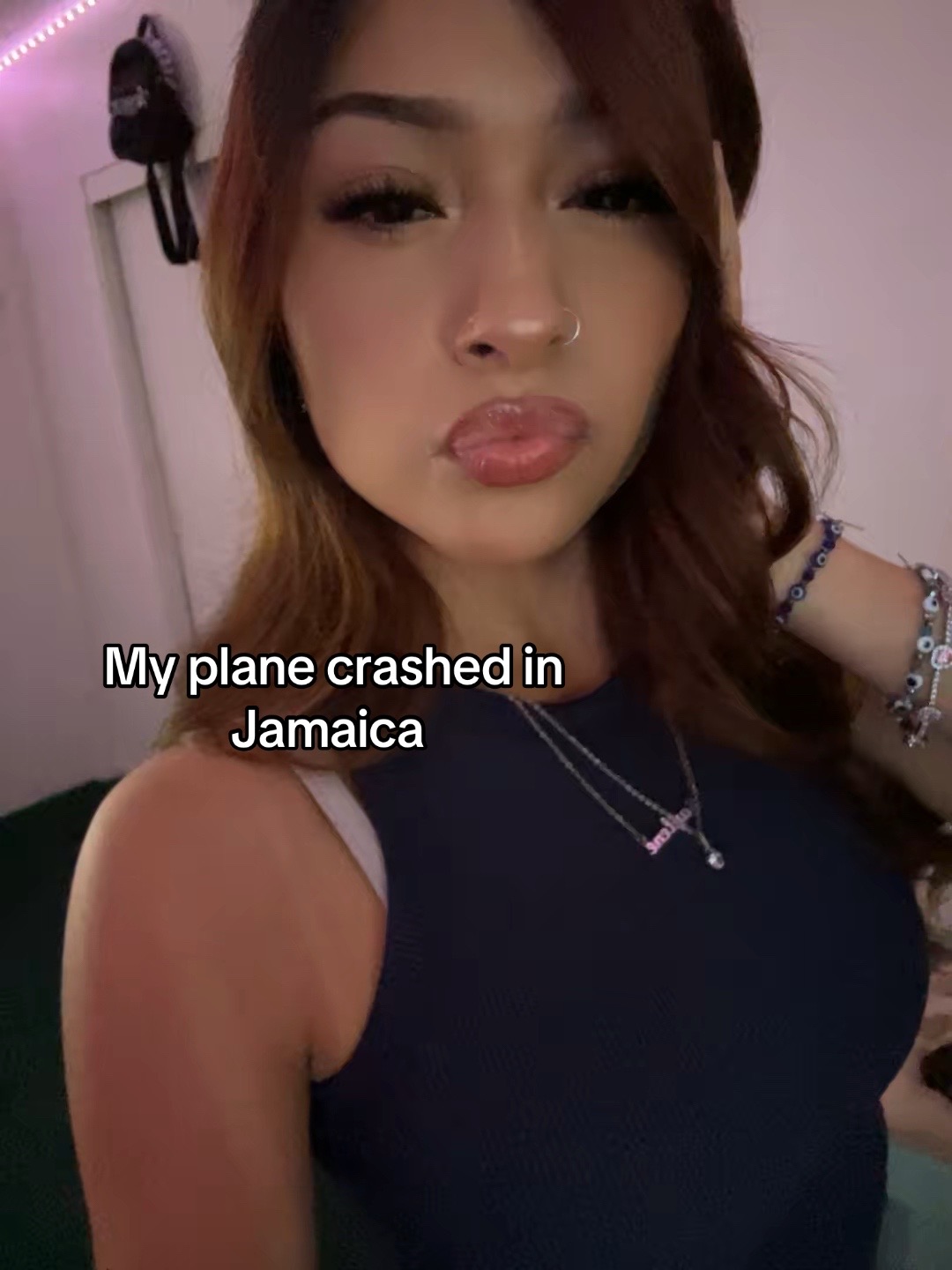 @unknown.ray.10