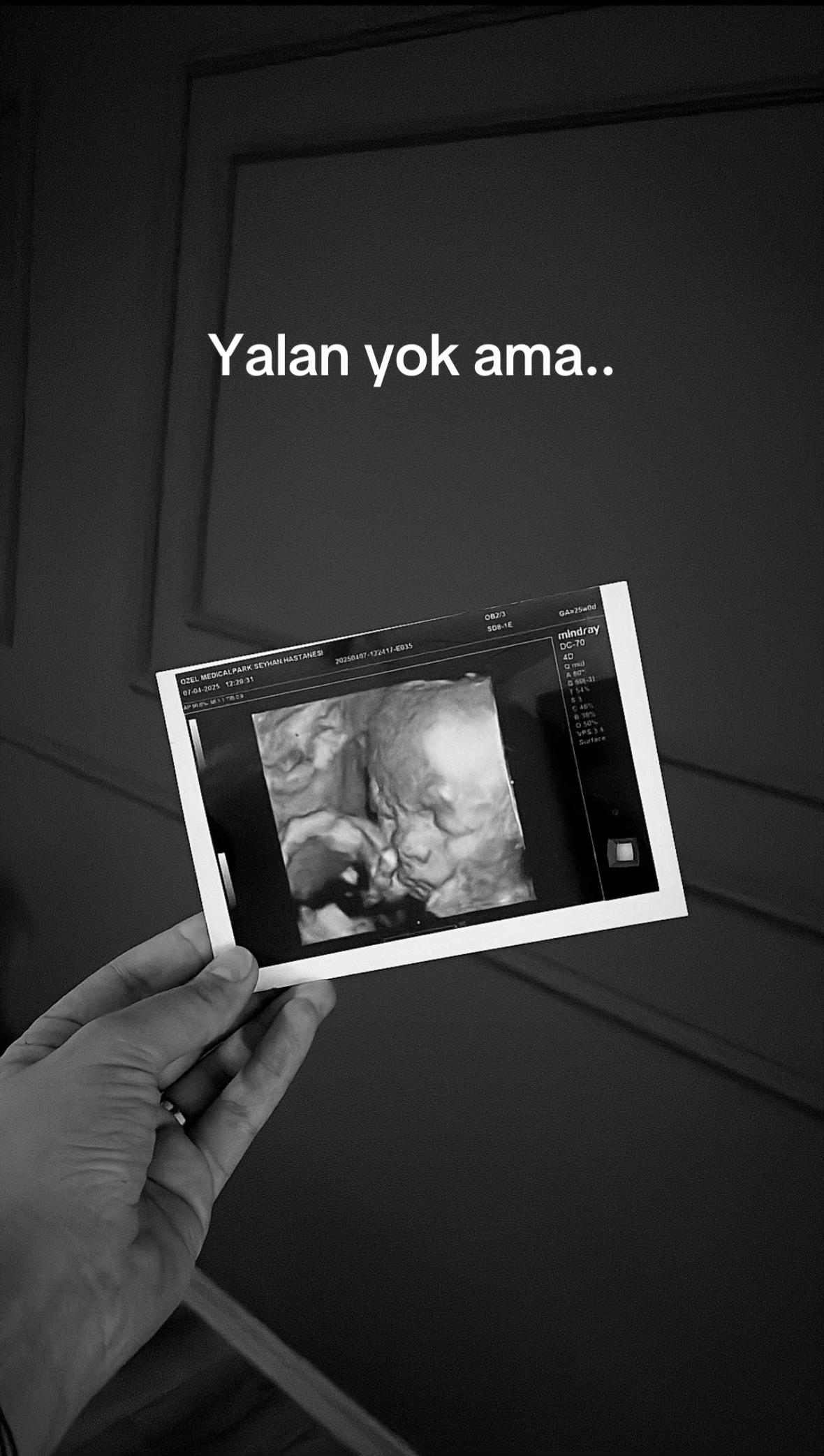 @Cansu Arıcı Eren