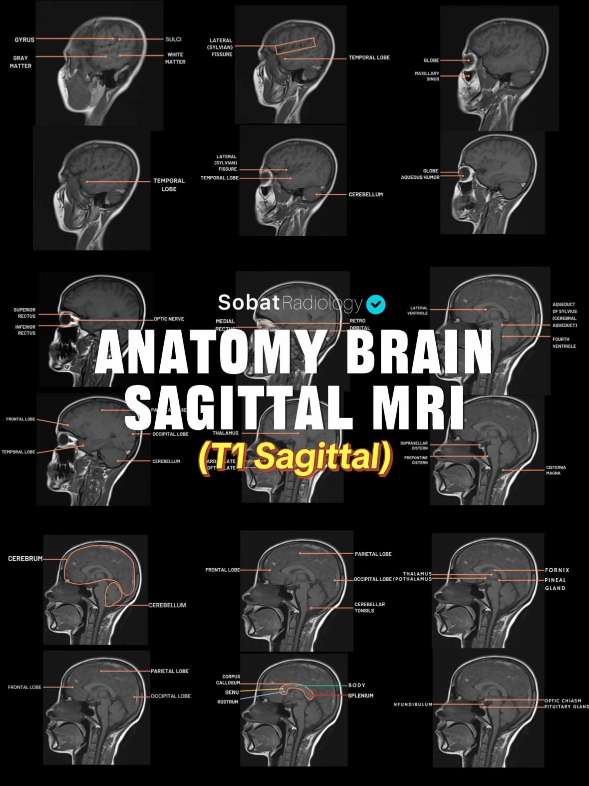 @Sobat Radiology