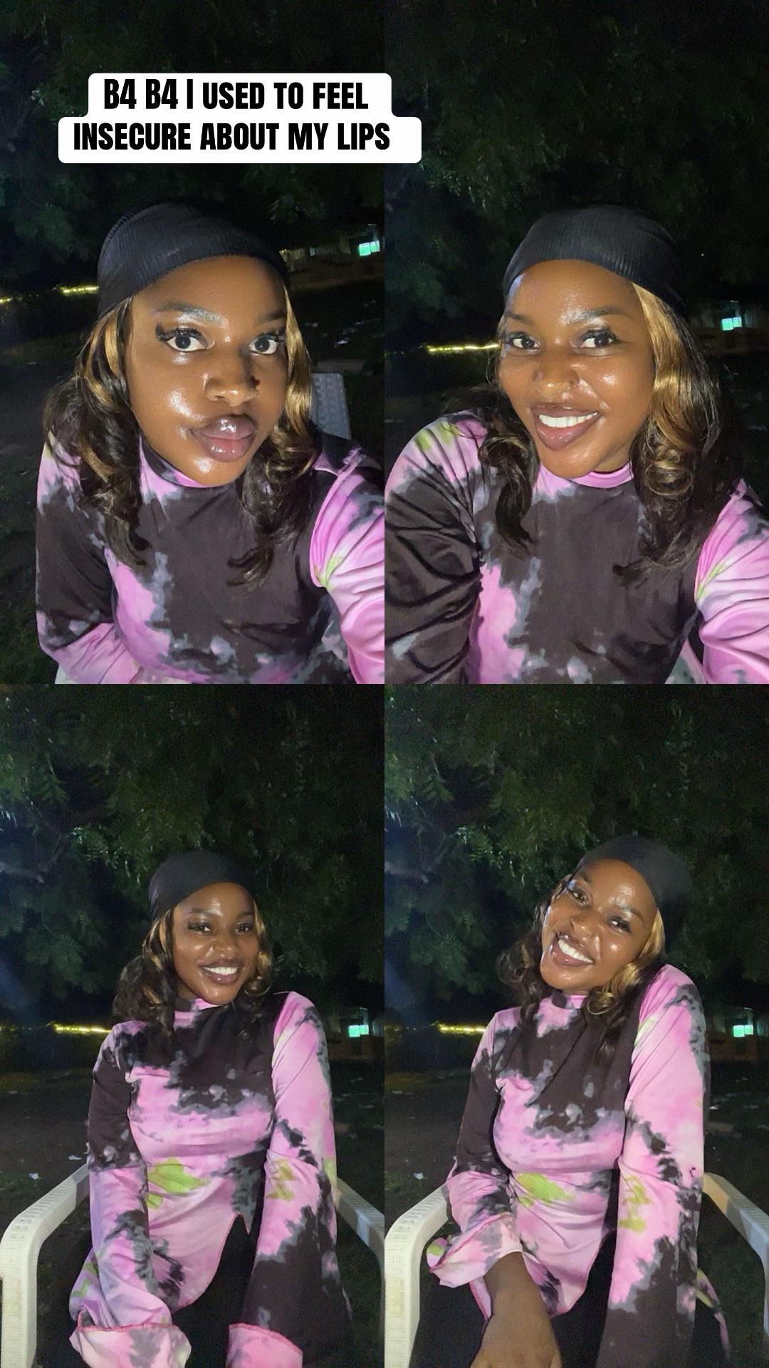 @Yetty baby🥰