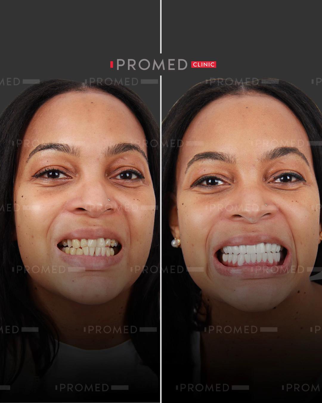 @promeddentalclinic