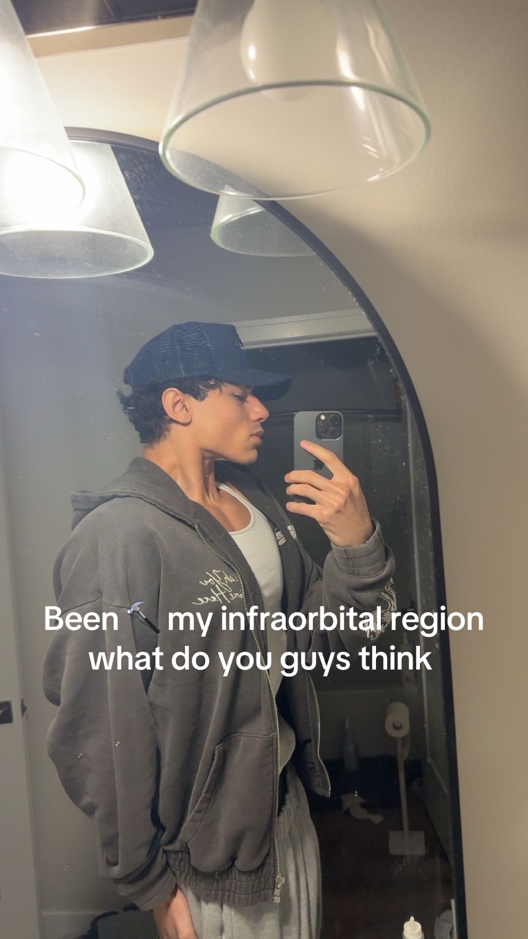 @strictlybone