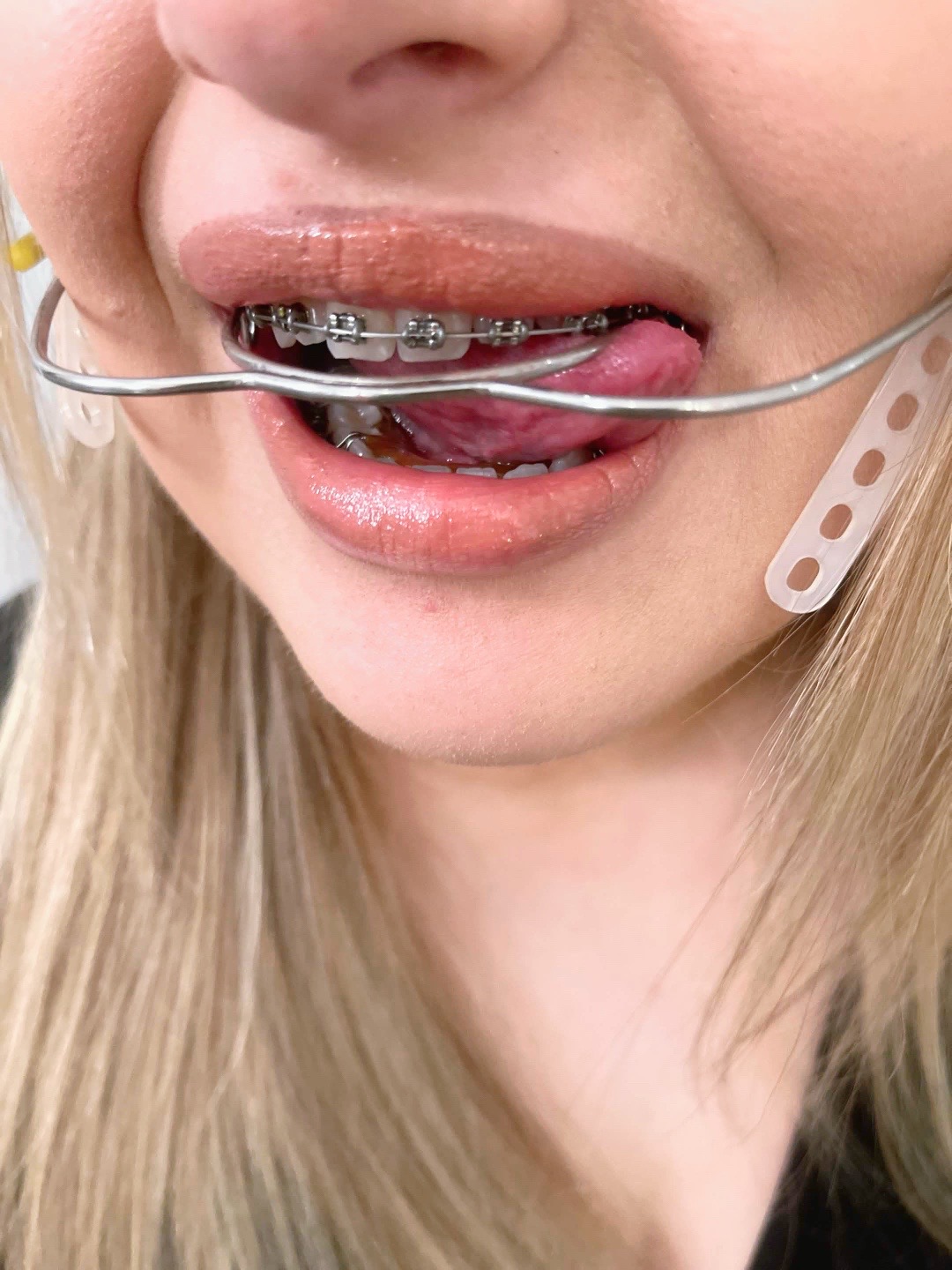 @TeethfairyEvah