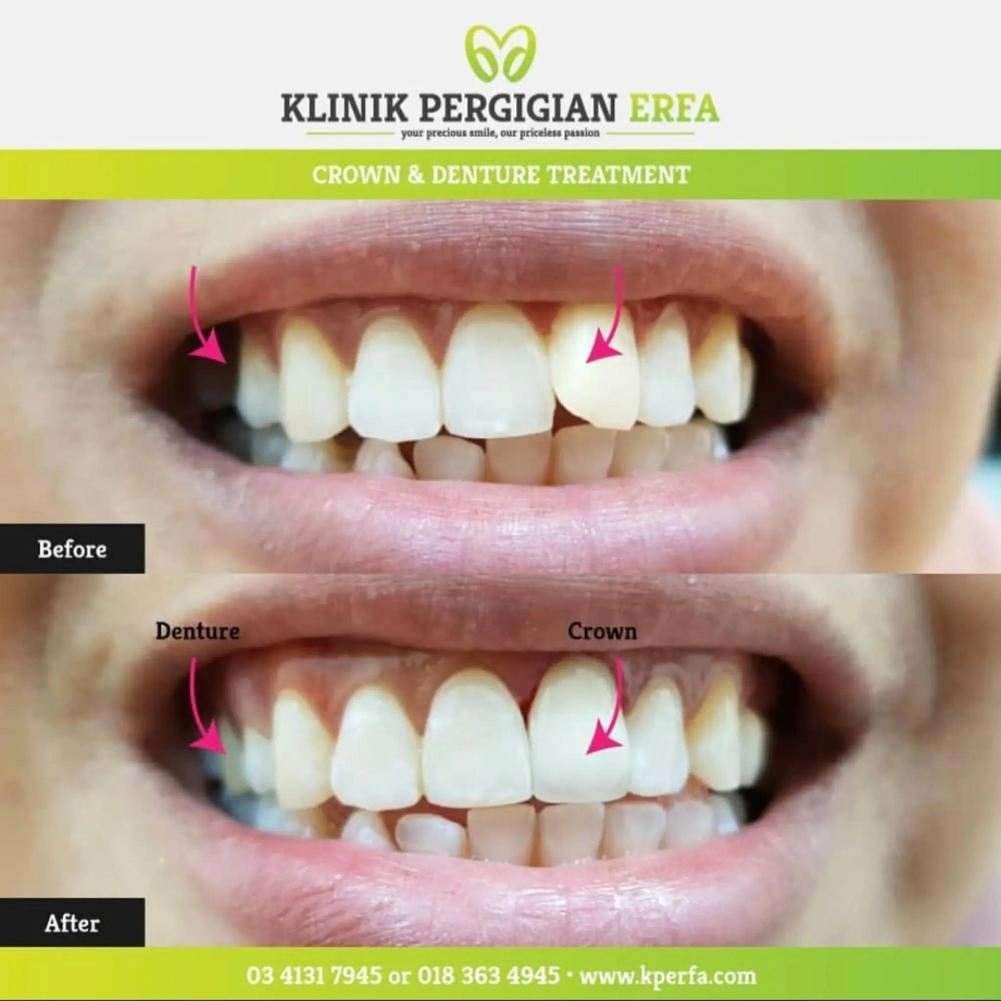 @Klinik Pergigian Erfa