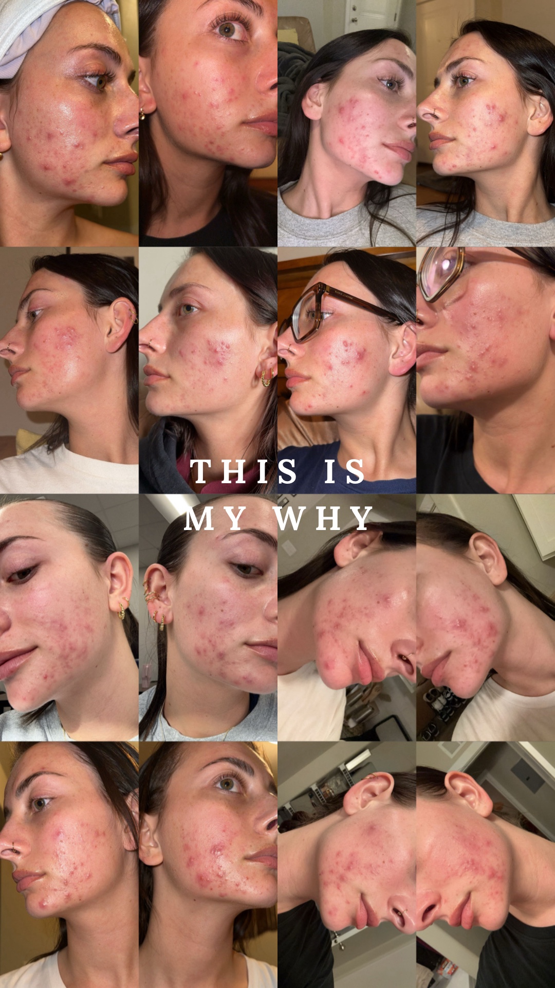 @MAISY | CA ESTHETICIAN