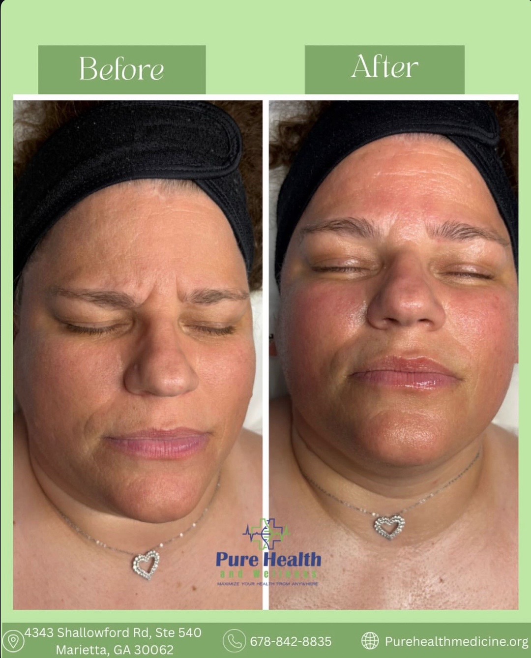 @PureHealthand_Wellness