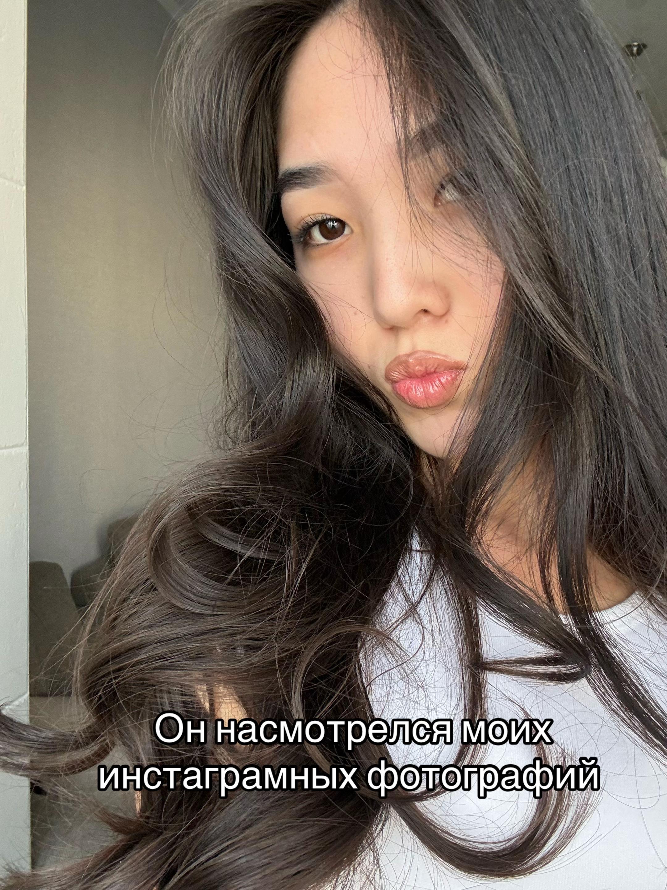 @Albino