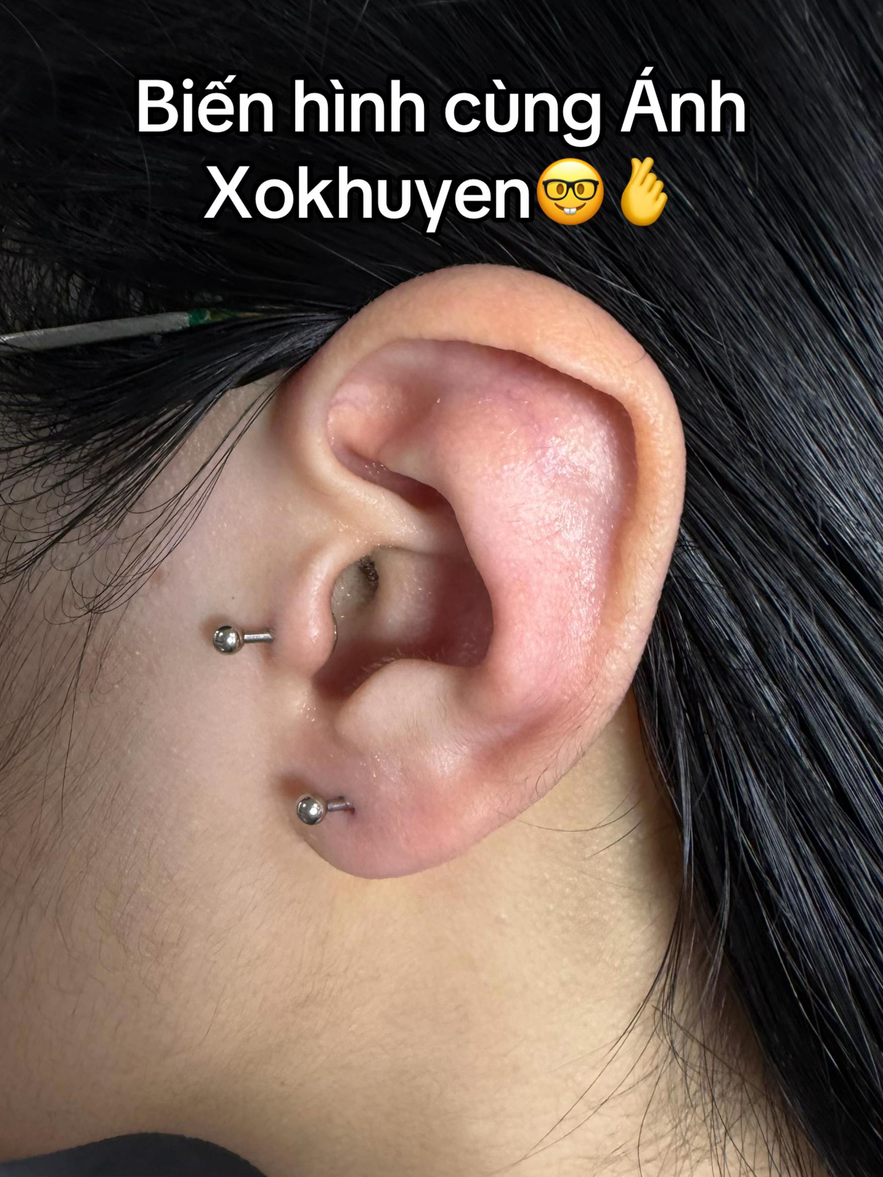 @&Aacute;nh Xokhuyen🪡