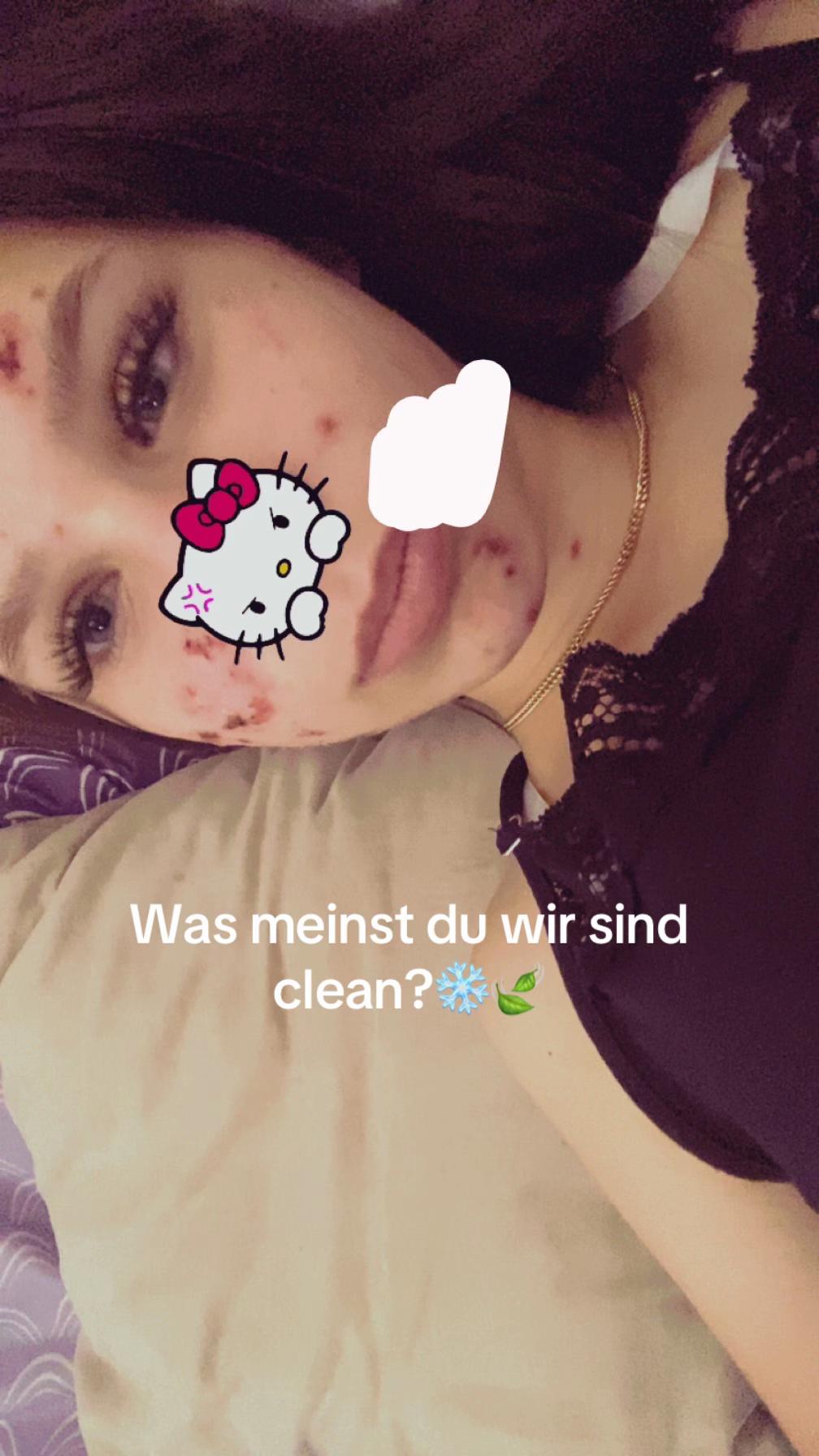 @Elisa