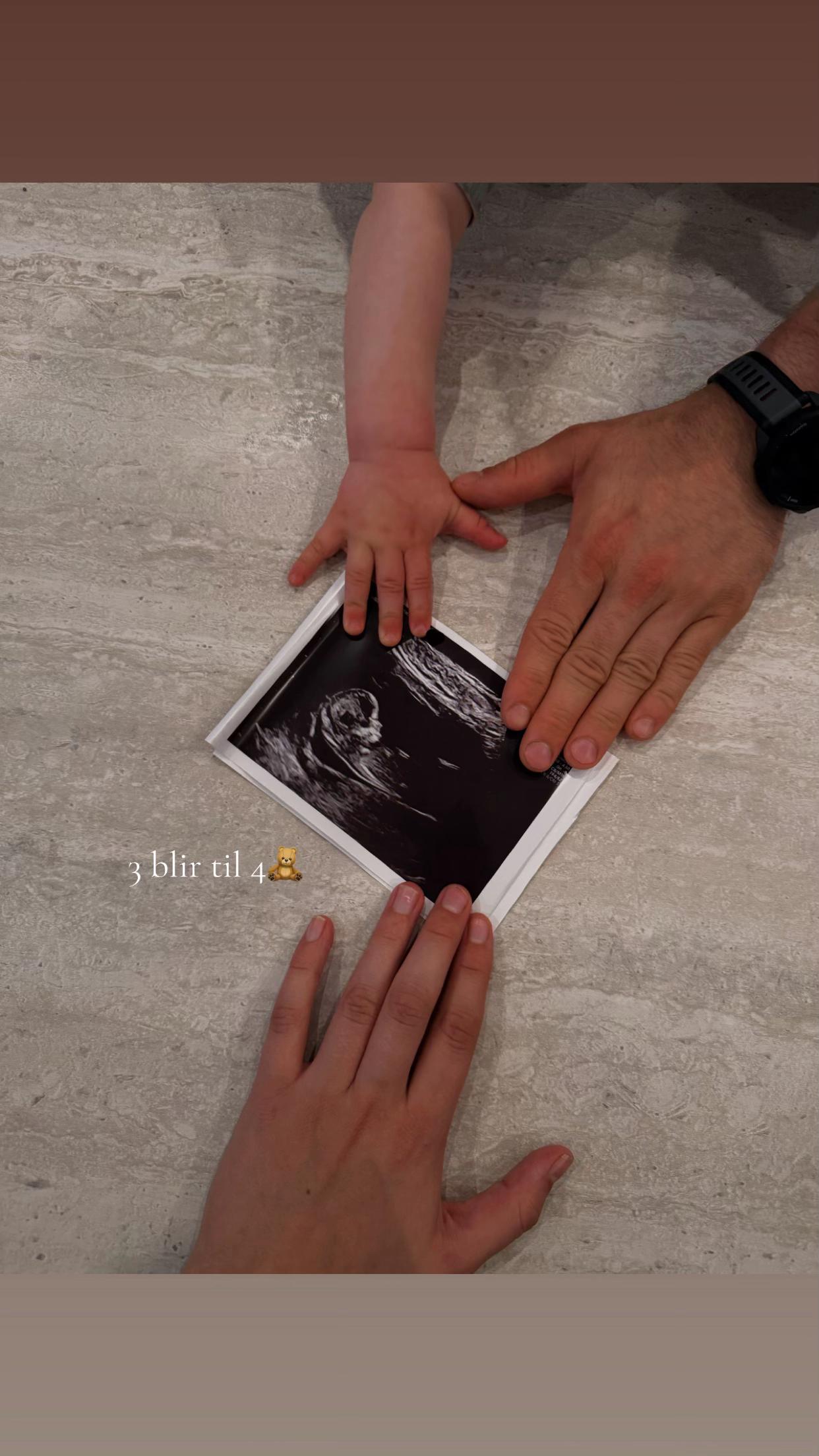 @Anny Molvær👶🏼✨🧸