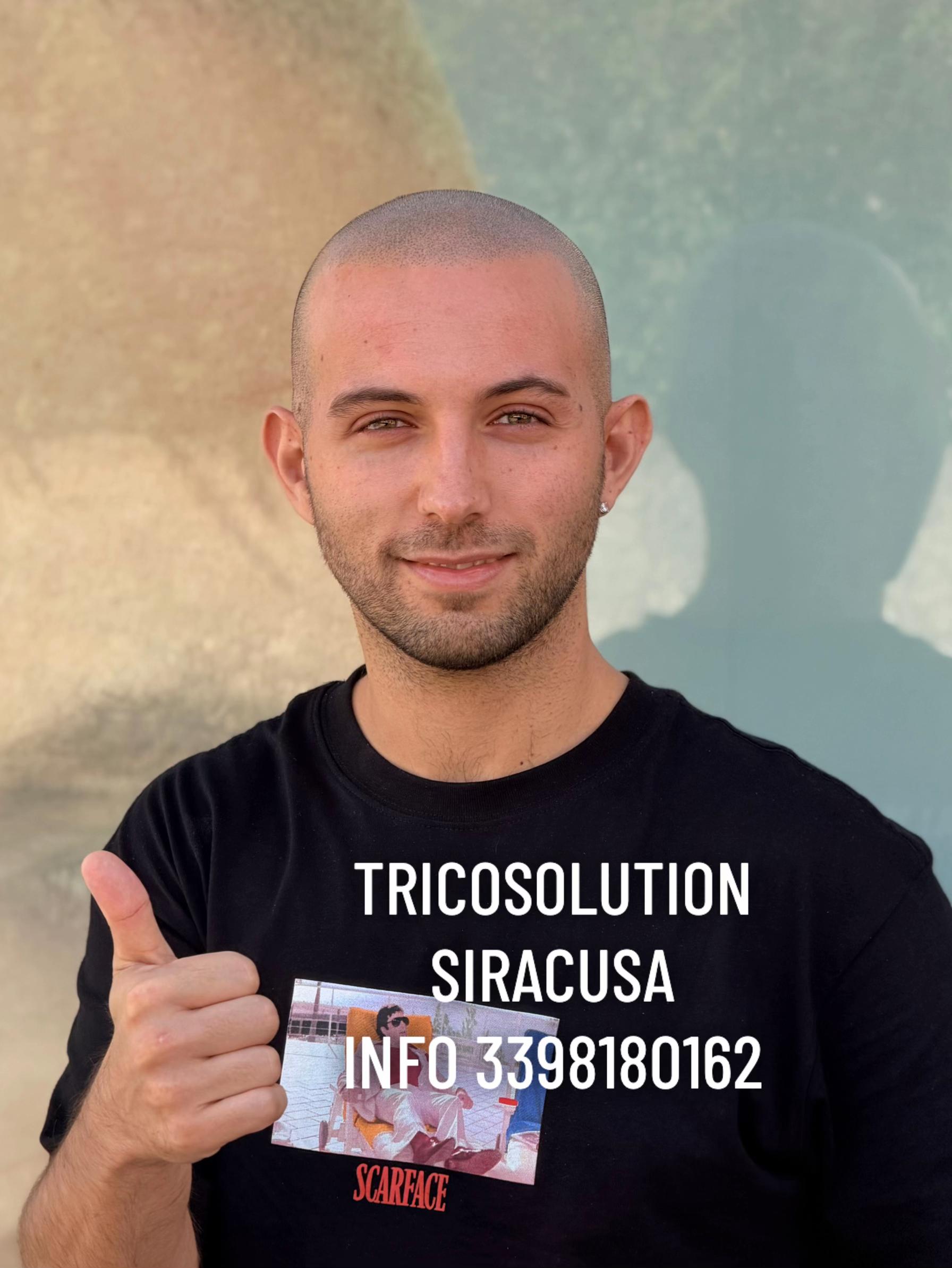 @TricoSolution di Davide Tini