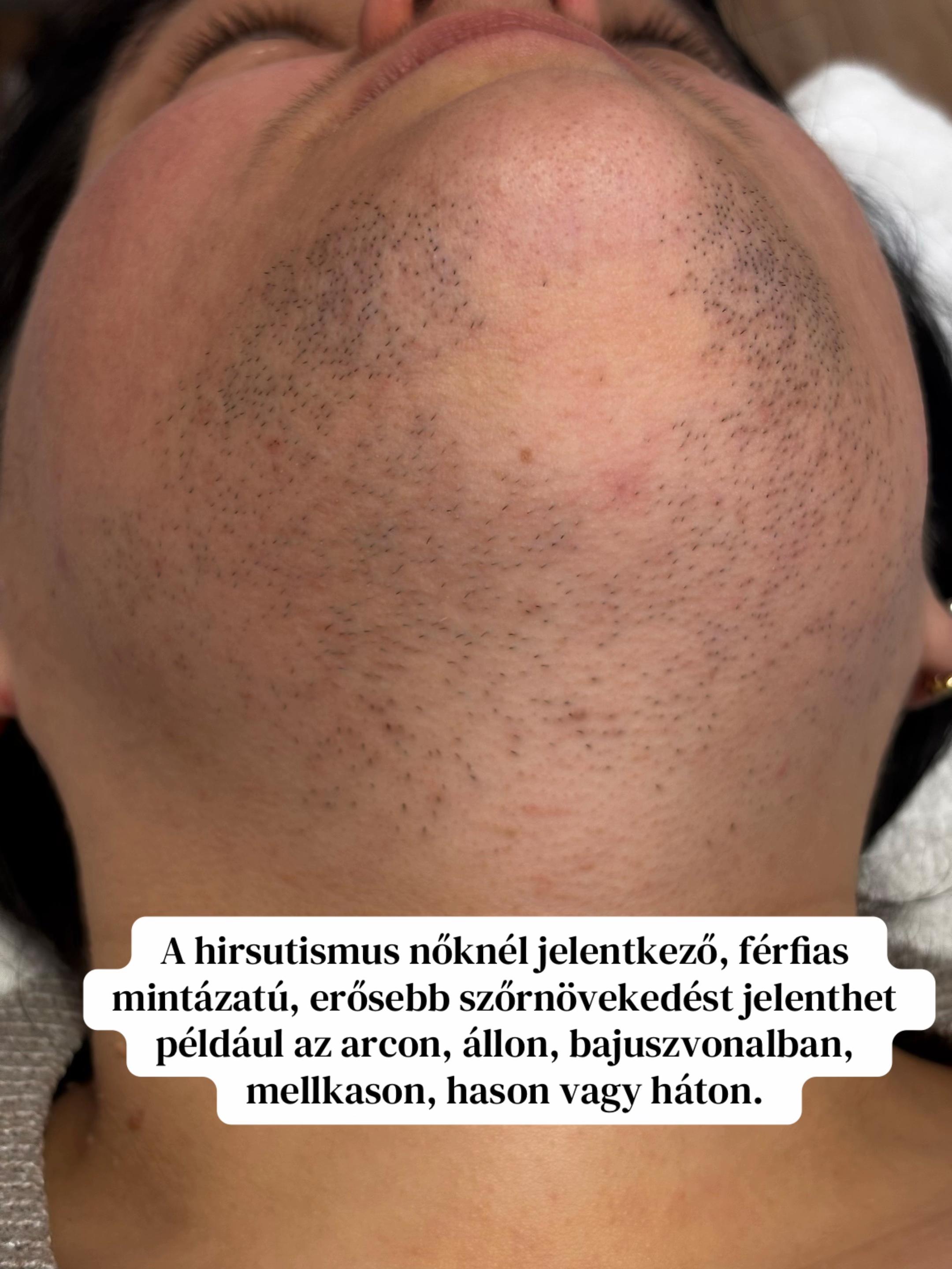 @P&aacute;ll Patr&iacute;cia Bőrterapeuta