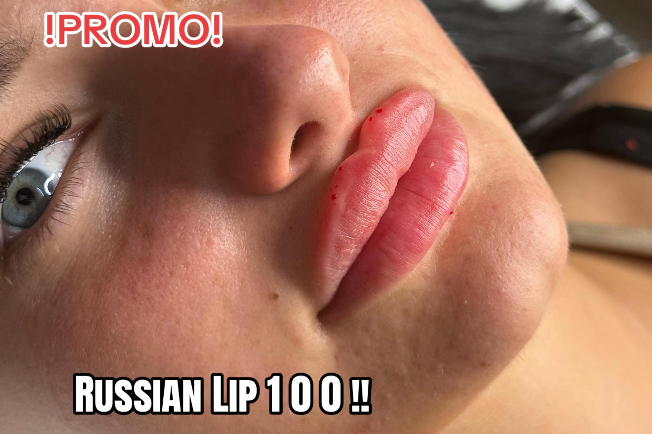 @Rosa.medical.cosmetic💉💕