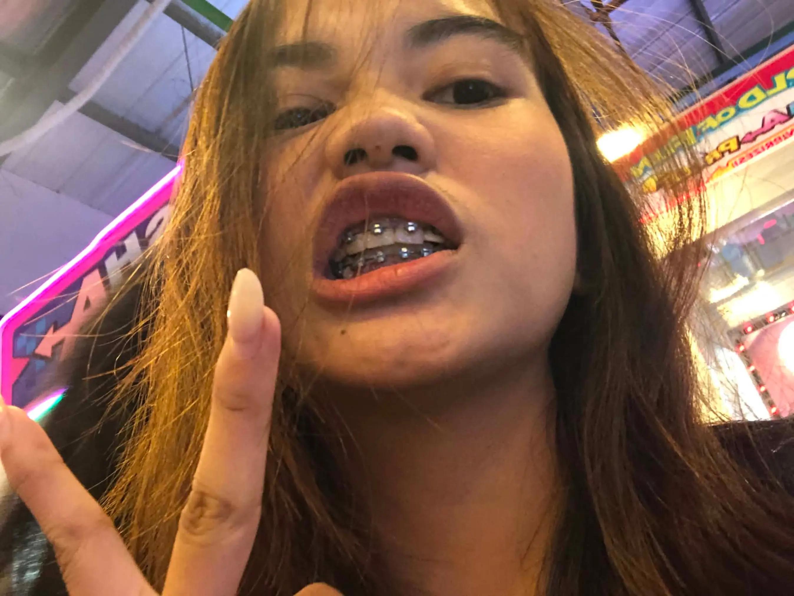 @thealapya