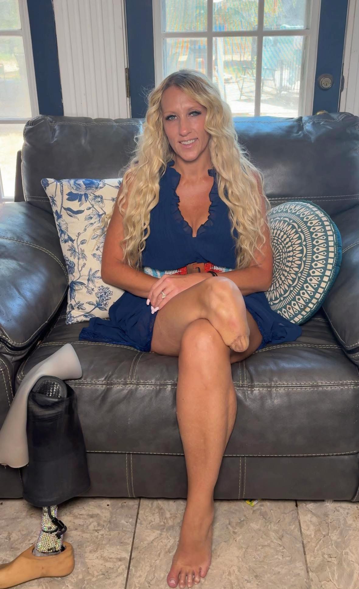 @AmputeeAngie2555