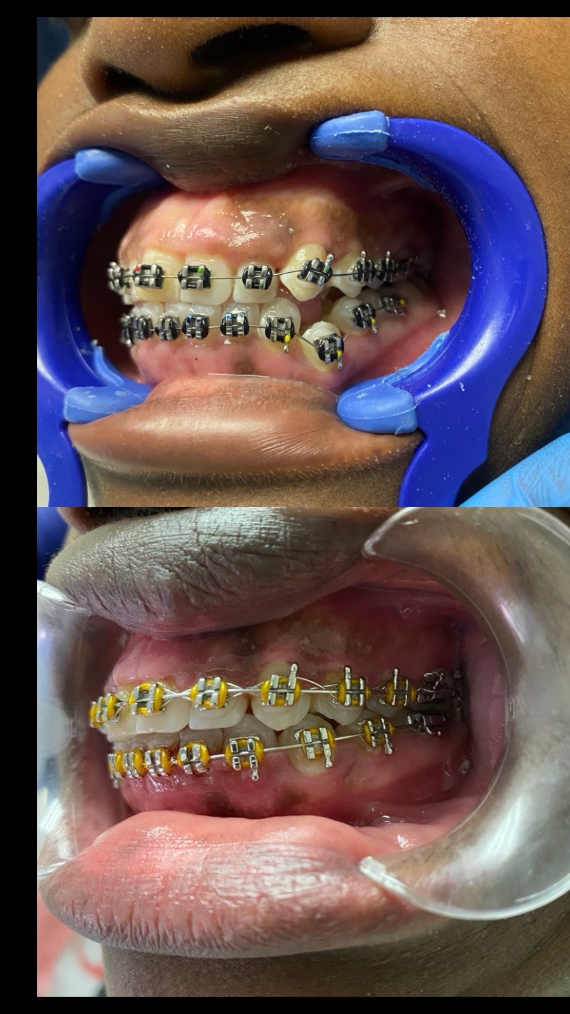 @DrTees