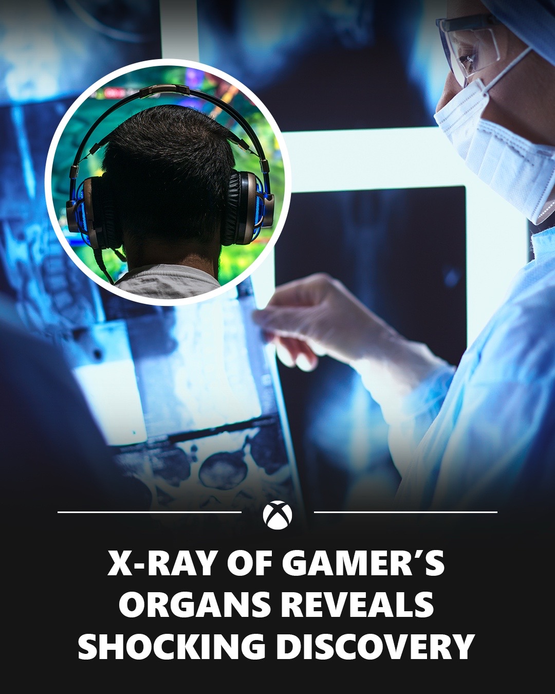 @XBOX