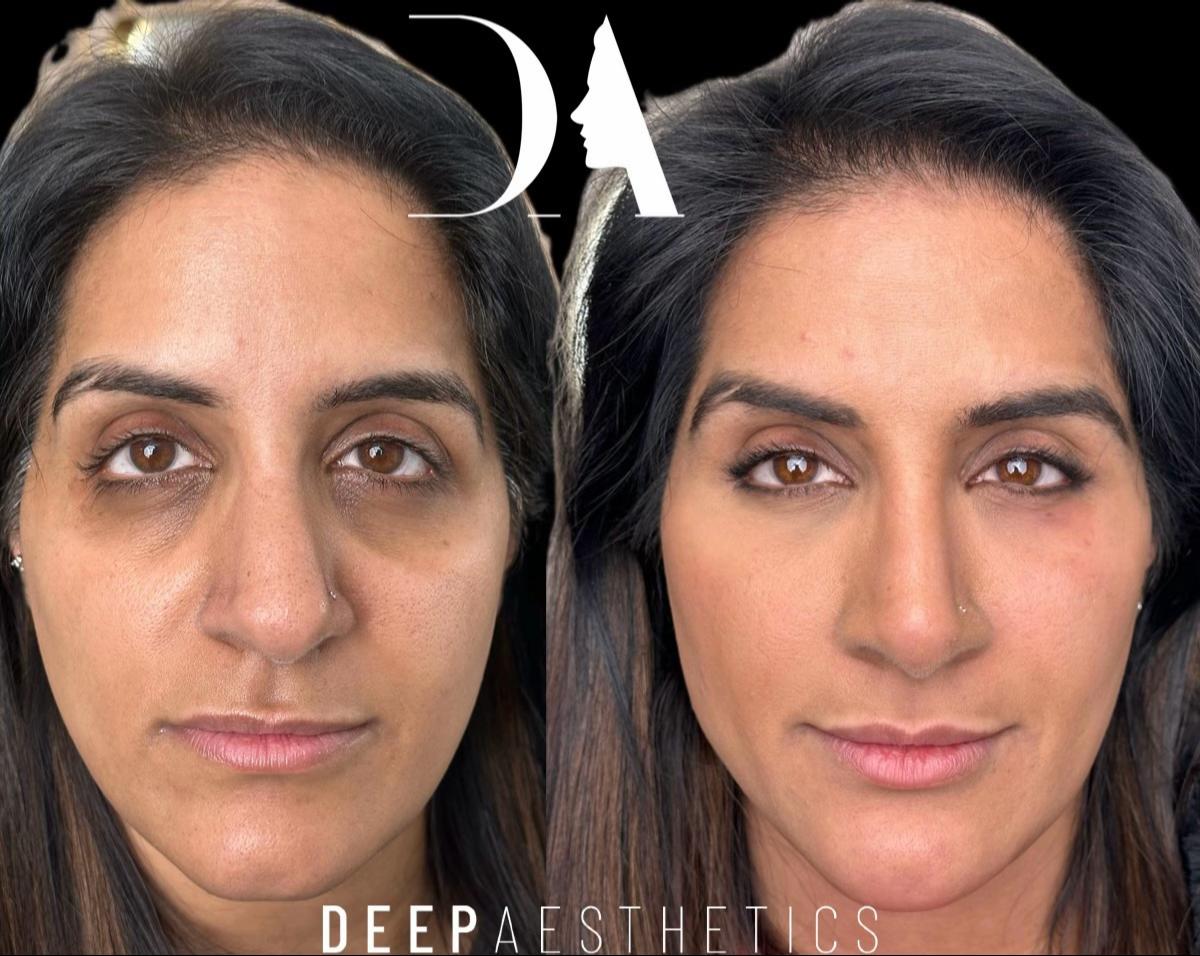 @deepaesthetics_official