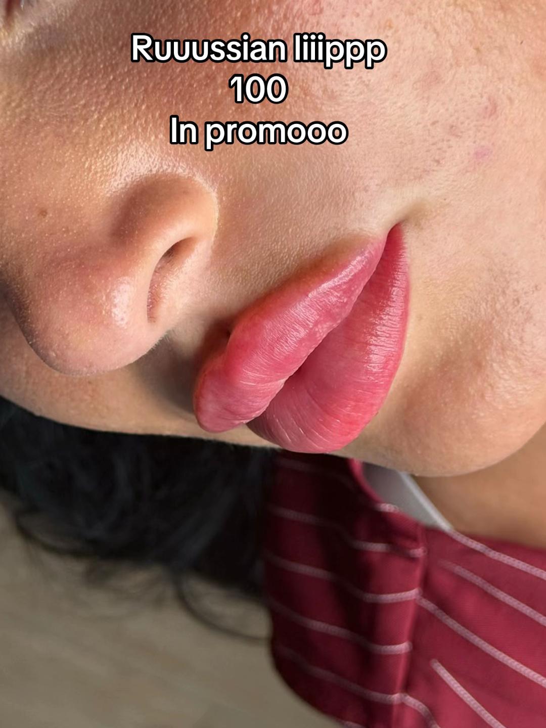 @Rosa.medical.cosmetic💉💕