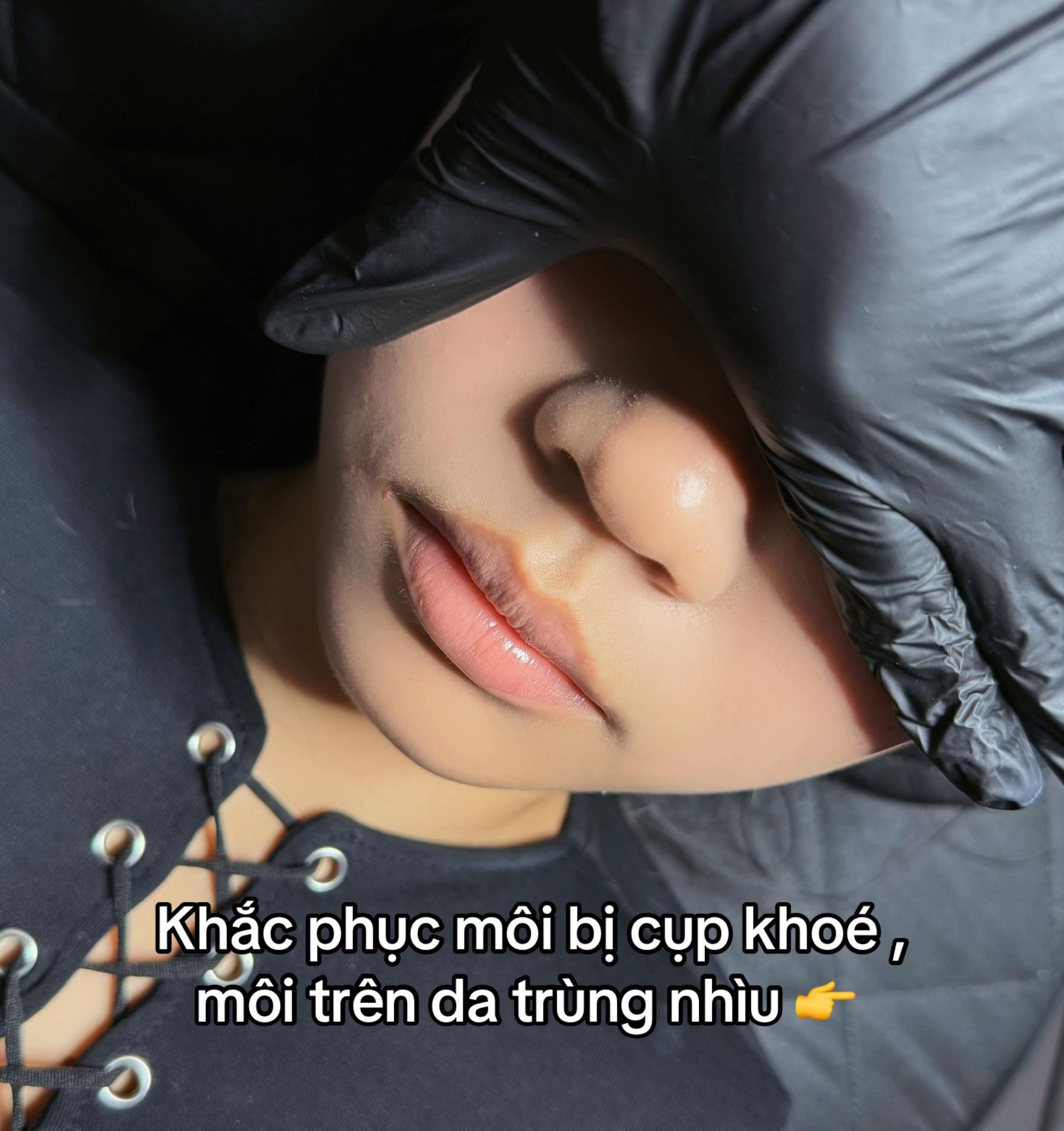 @TRẦN TRANG FILLER BÌNH THUẬN💉