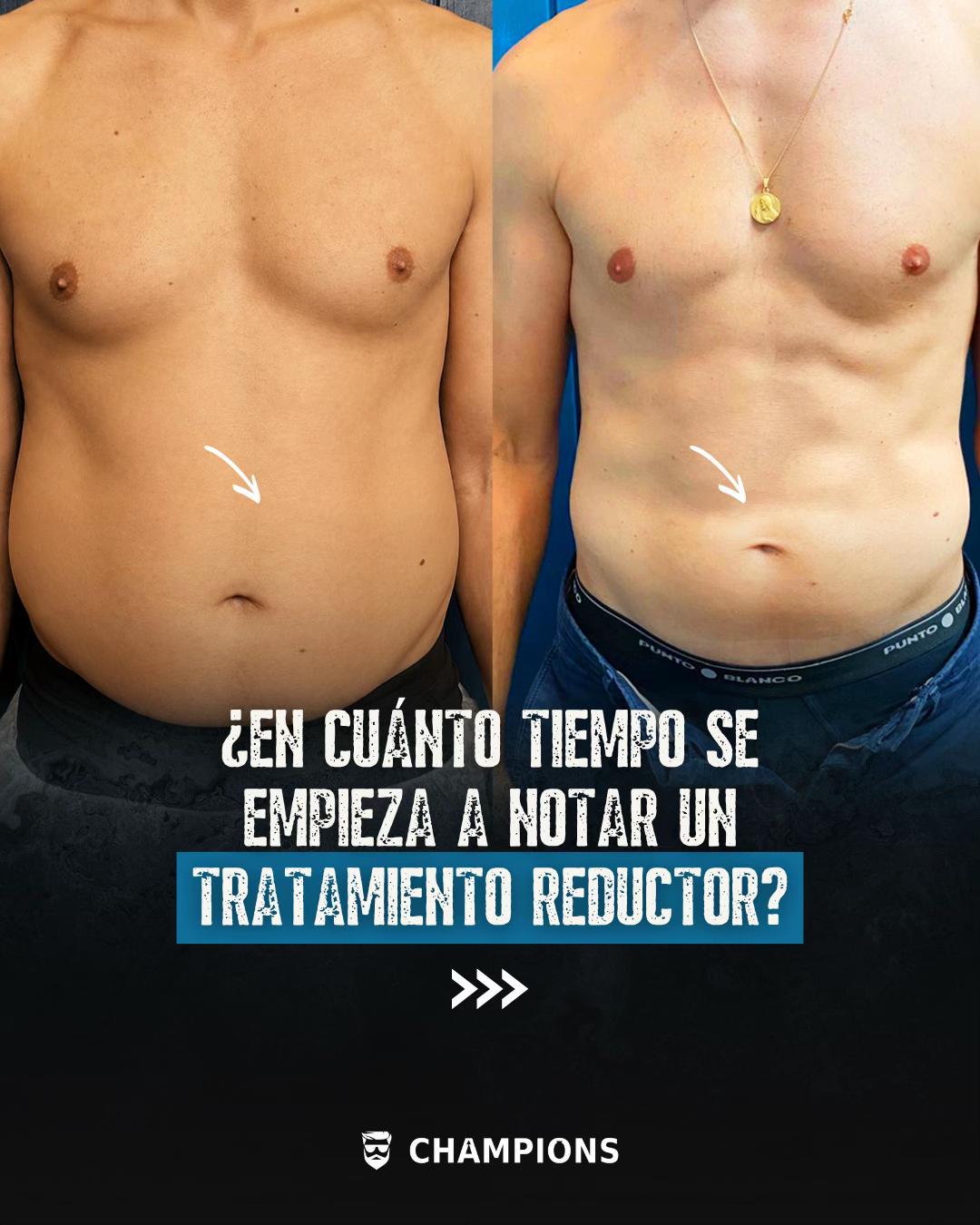 @Champions.men