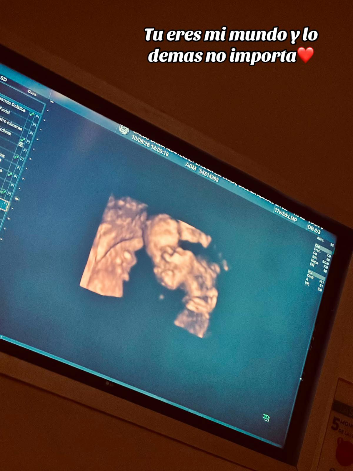 @𝓐𝓫𝓲𝓰𝓪𝓲𝓵🌷