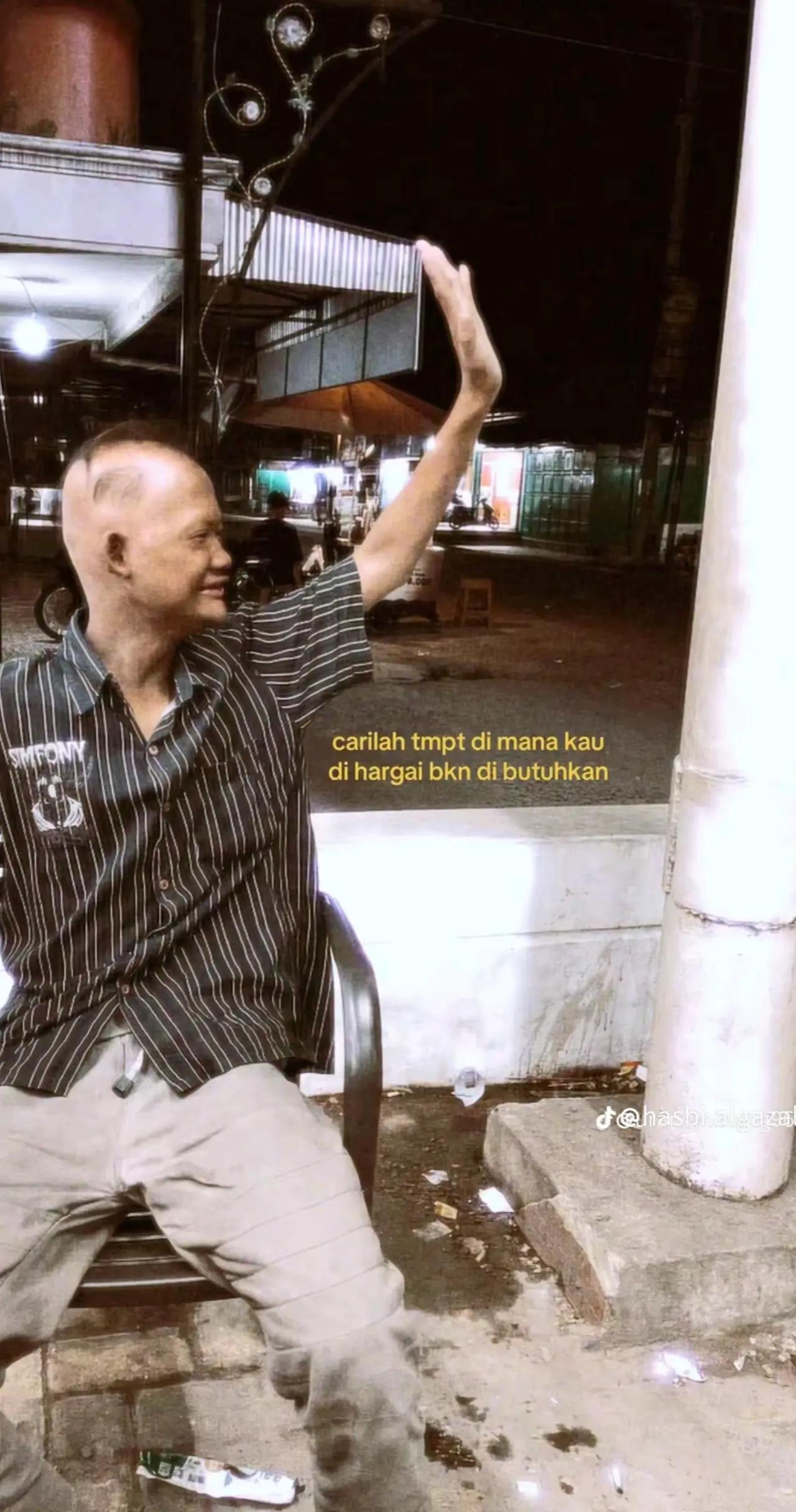 @dim