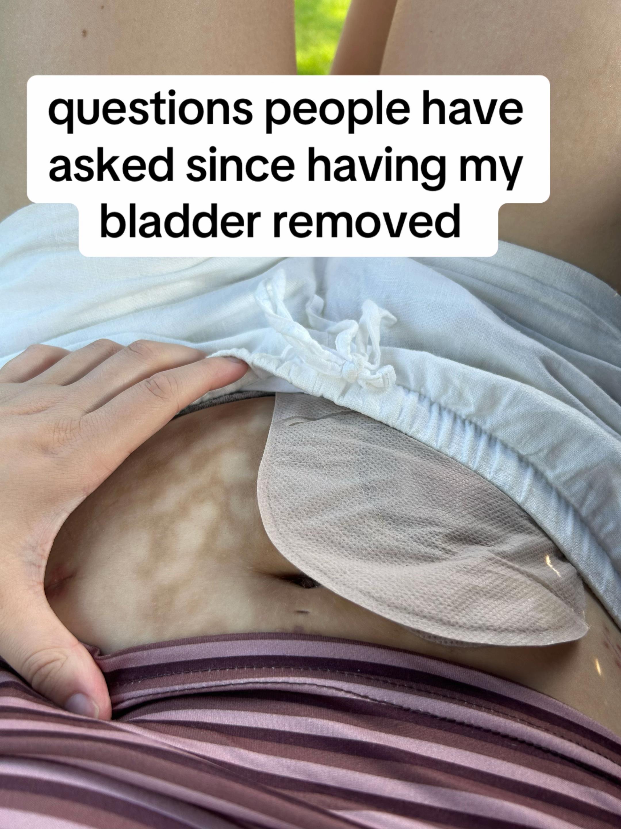@tonisbrokenbladder
