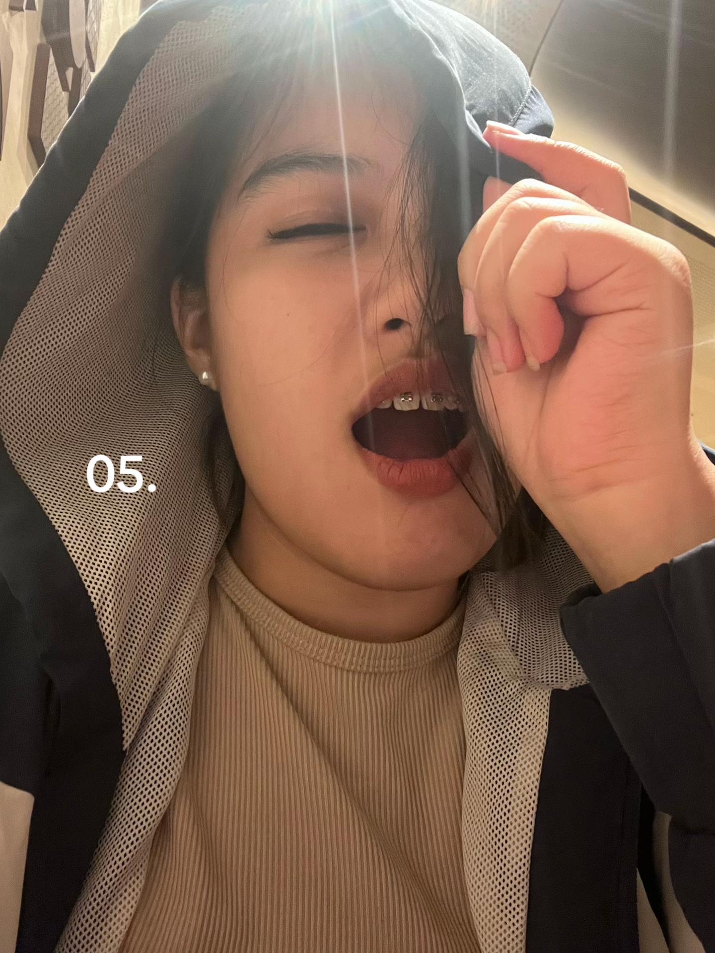 @레이