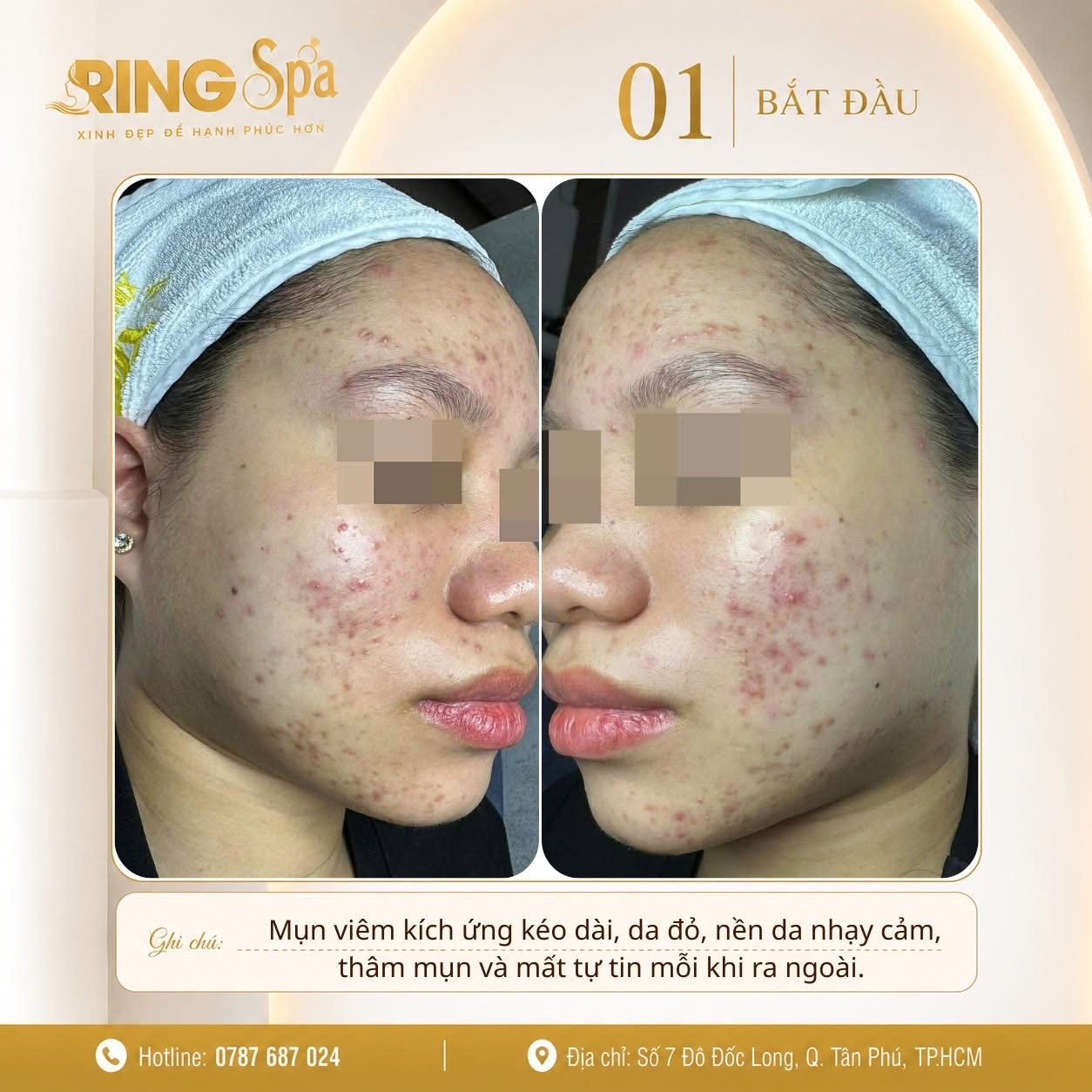 @Ring_Spa